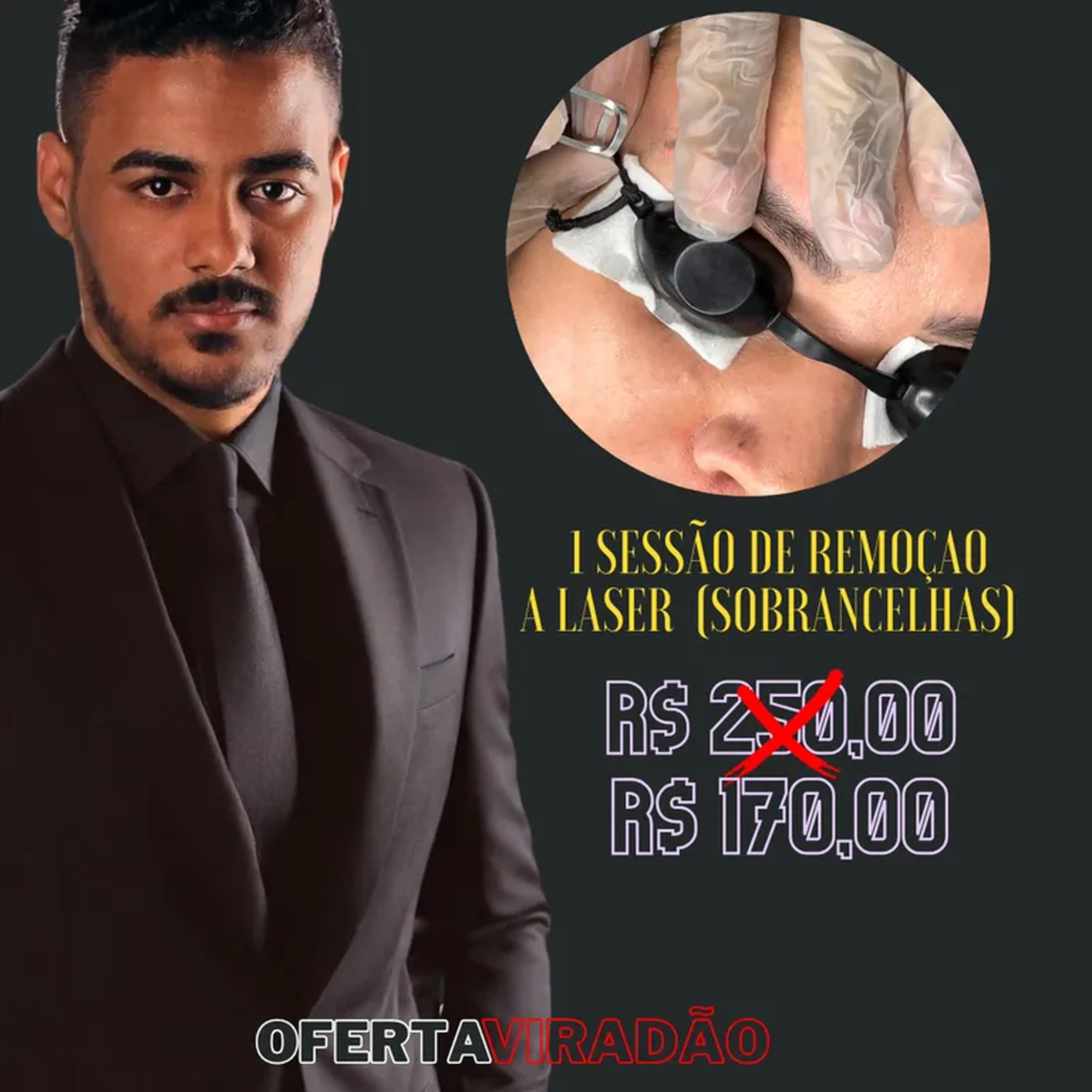 1 SESSÃO DE REMOÇÃO A LASER imagem