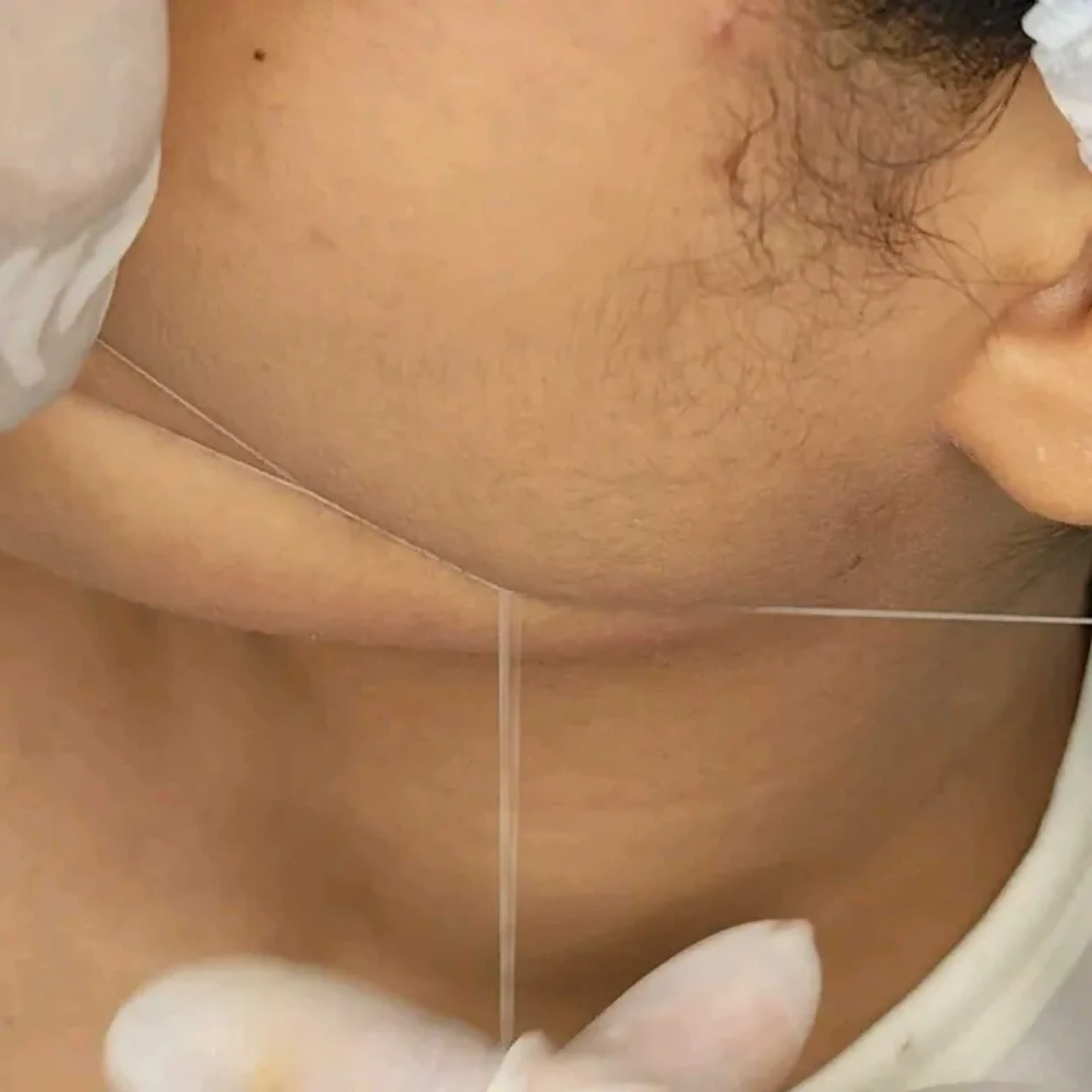 Epilação de buço e queixo imagem