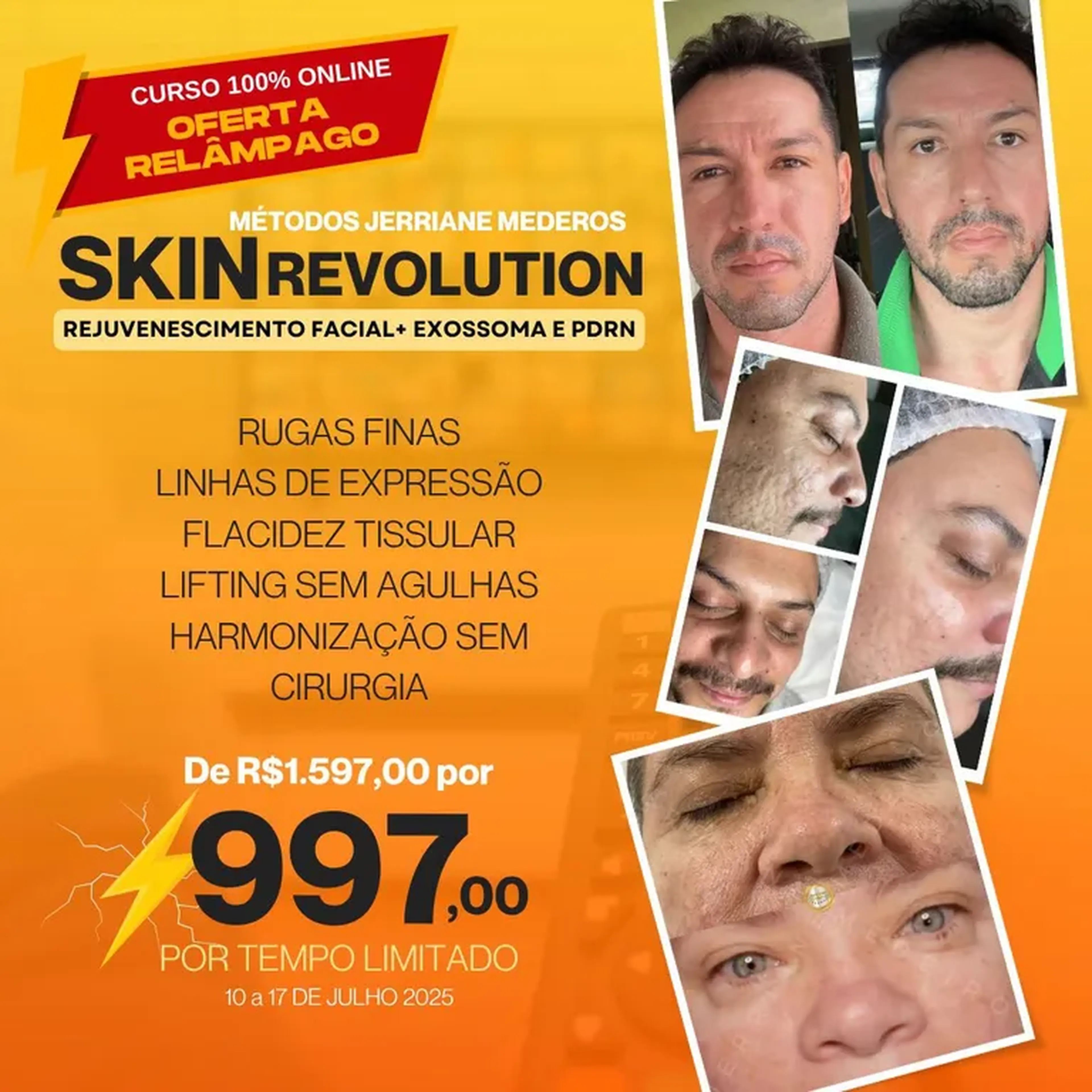 SKIN REVOLUTION OFERTA FÉRIAS imagem