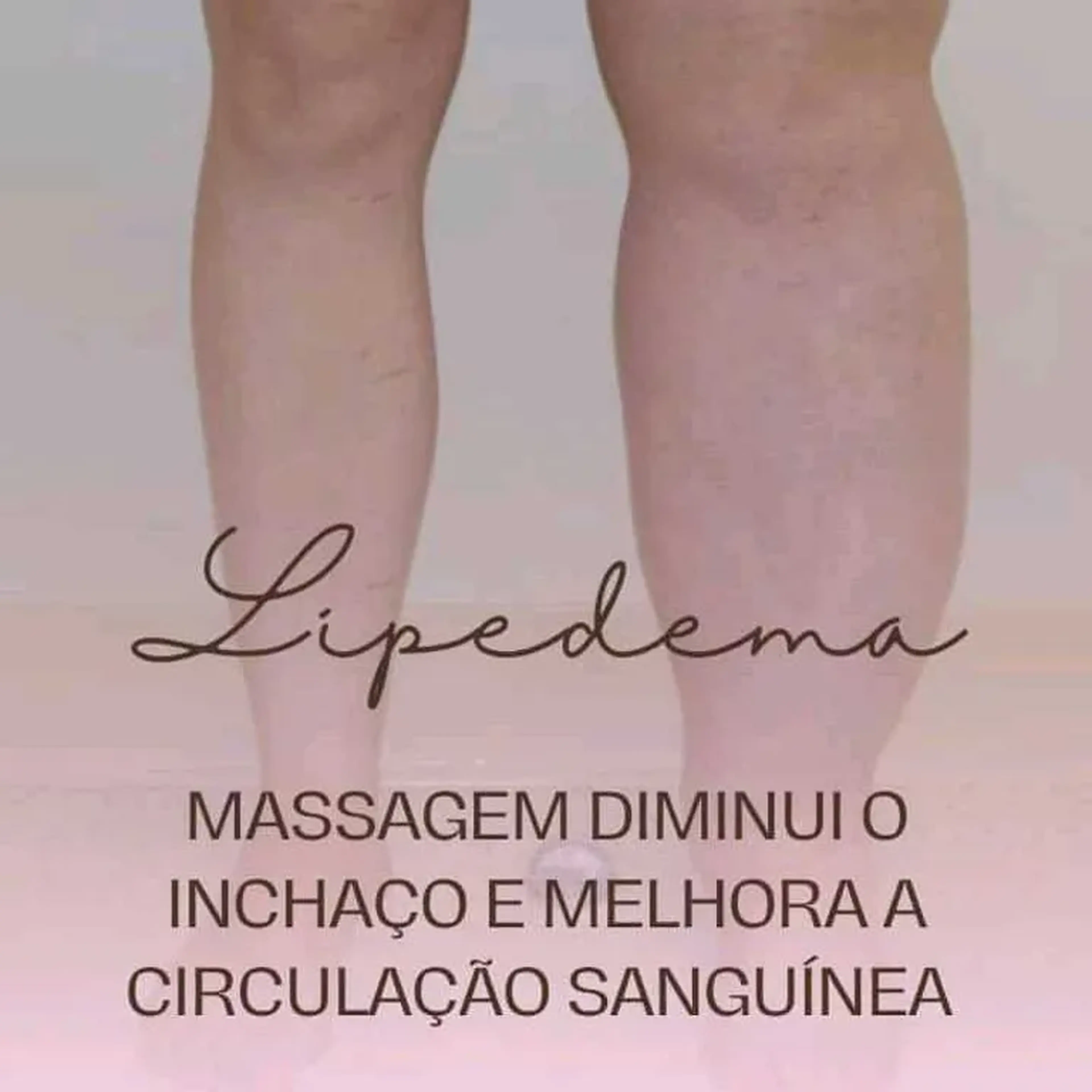 protocolo lipedema imagem