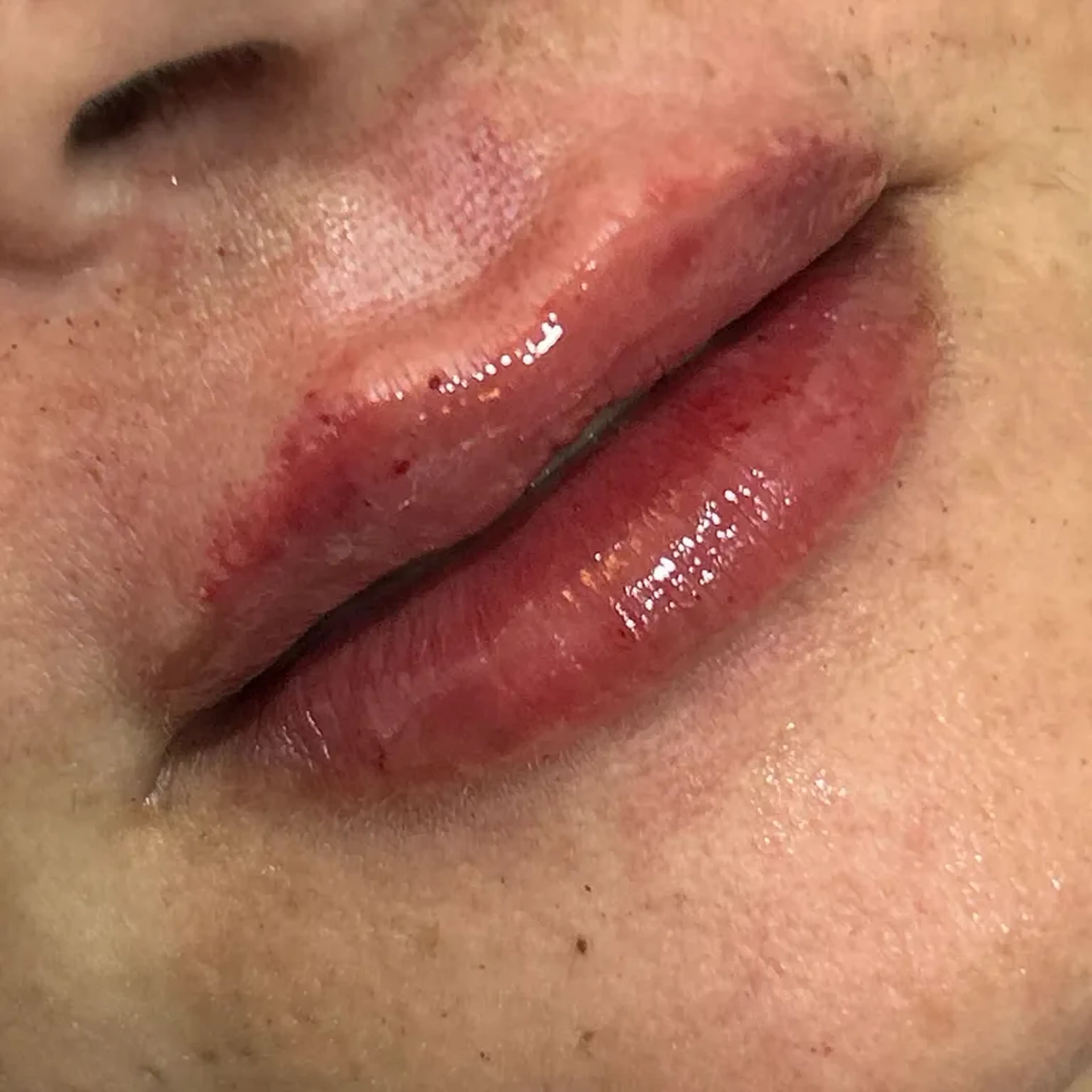 CURSO: 7 TÉCNICAS DE PREENCHIMENTO LABIAL imagem