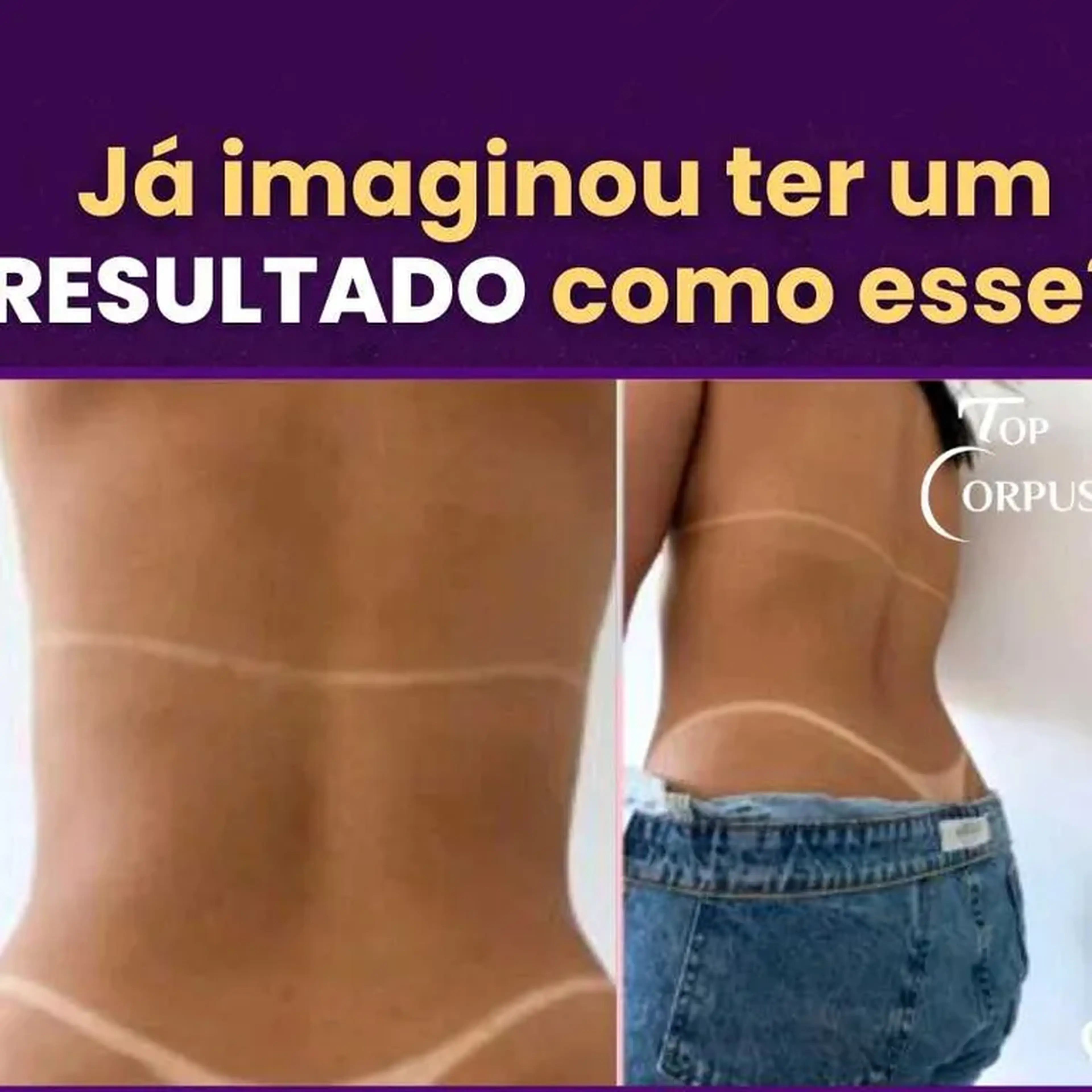 massagem Bronzeadora imagem