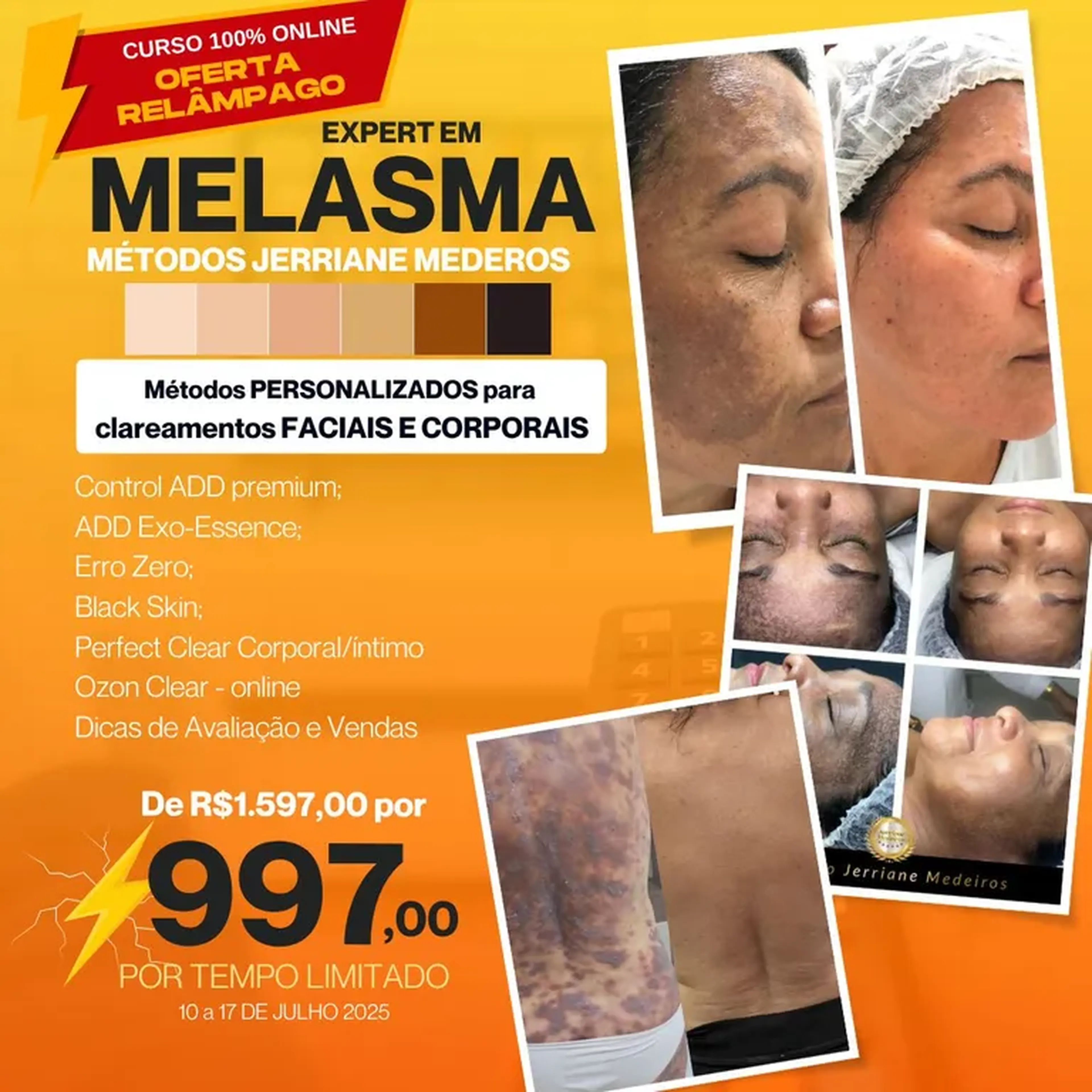 EXPERT EM MELASMA OFERTA FÉRIAS imagem