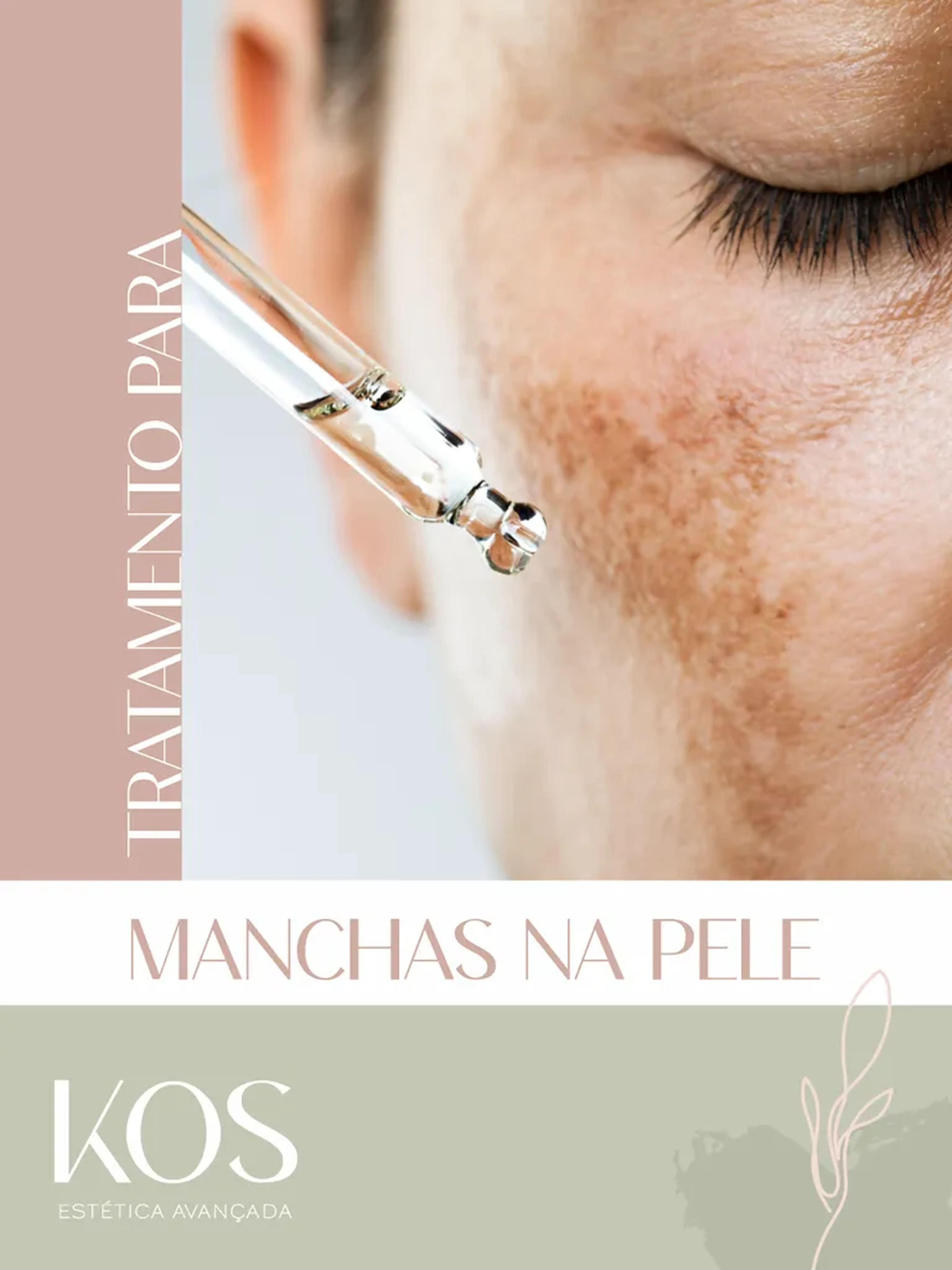 Manchas Faciais - Sessões Unitária imagem