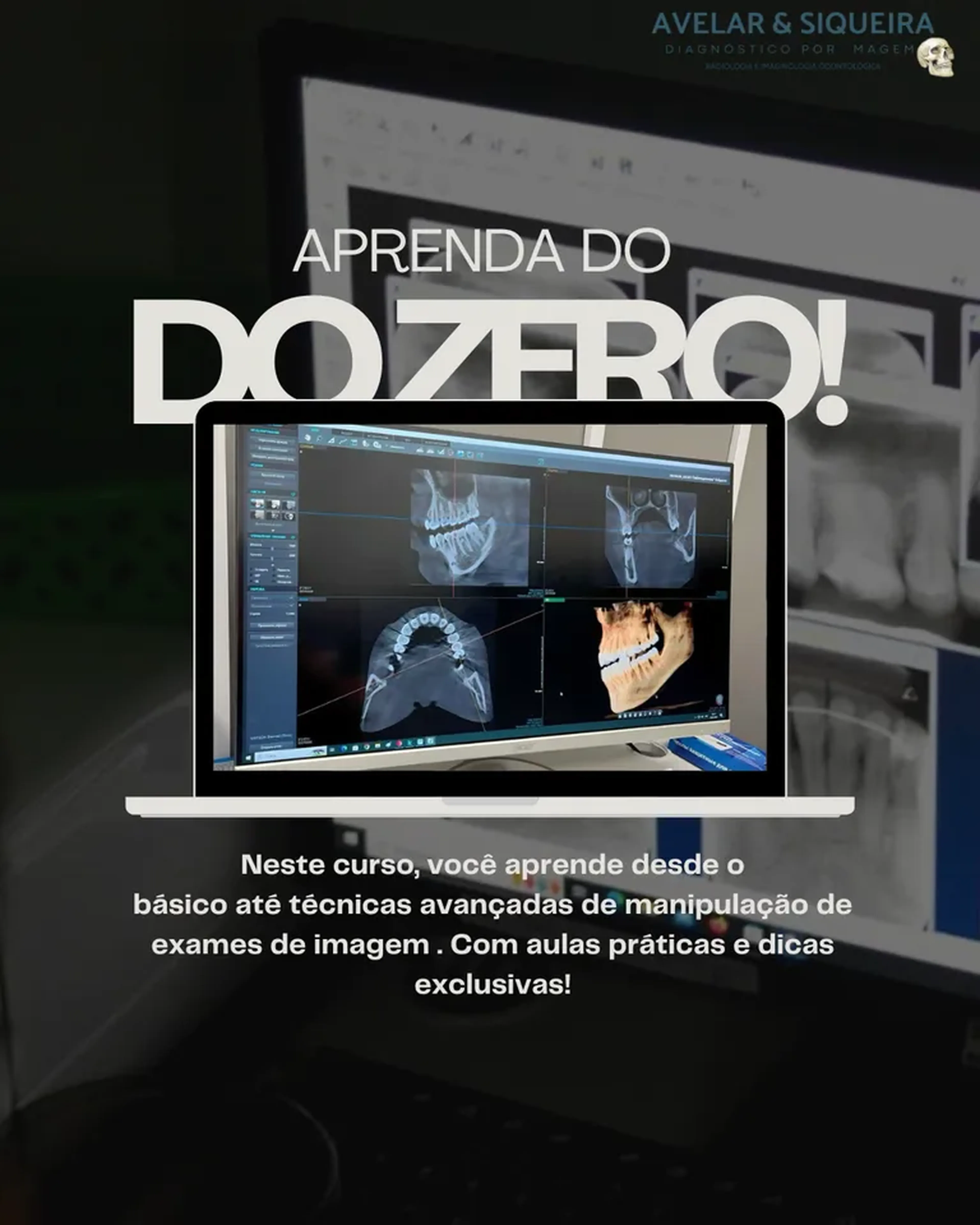 CURSO DE CAPACITAÇÃO EM TOMOGRAFIA imagem