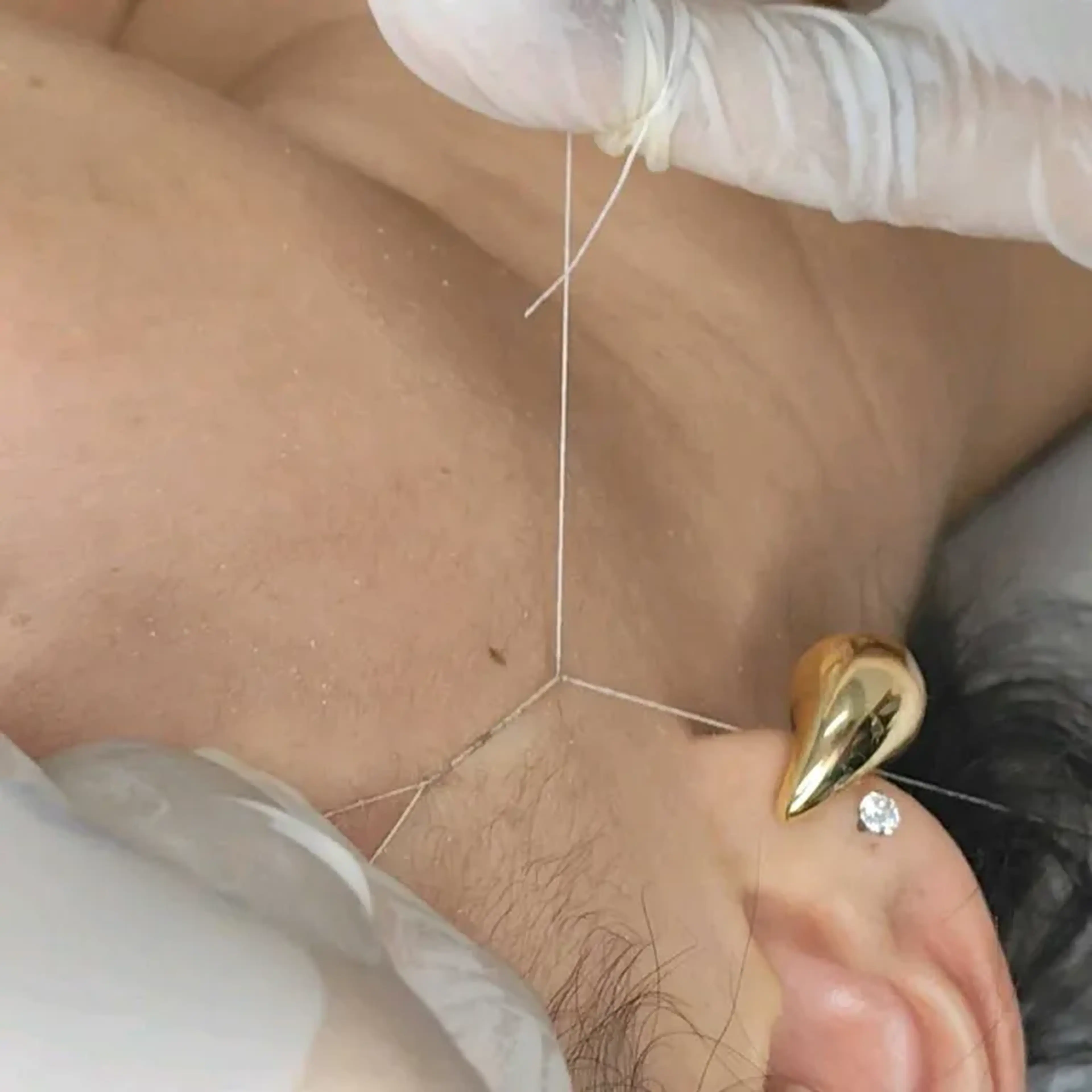 Epilação facial completa imagem