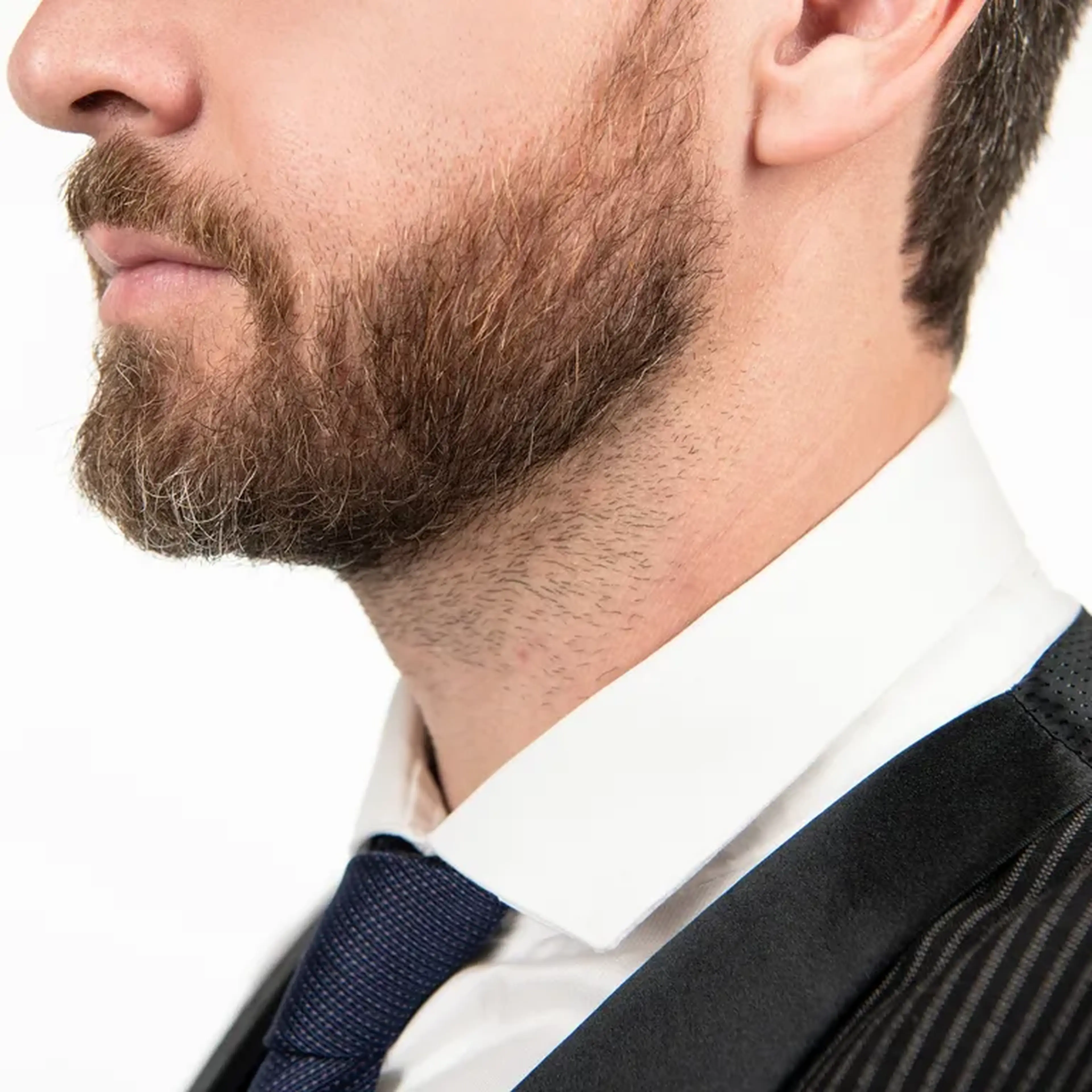 Depilação a Laser Faixa de Barba (10 sessões) imagem