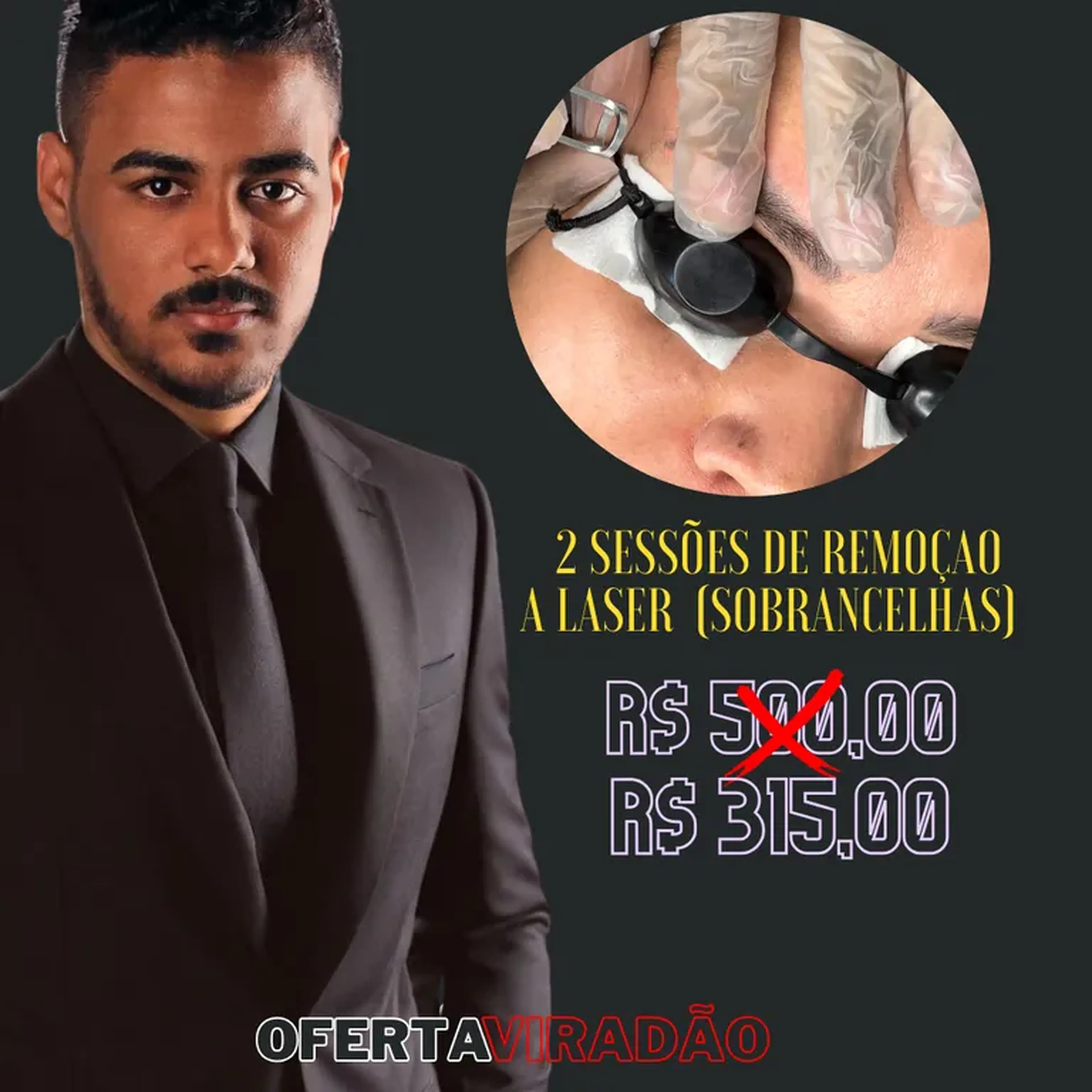 2 SESSÕES DE REMOÇÃO A LASER imagem