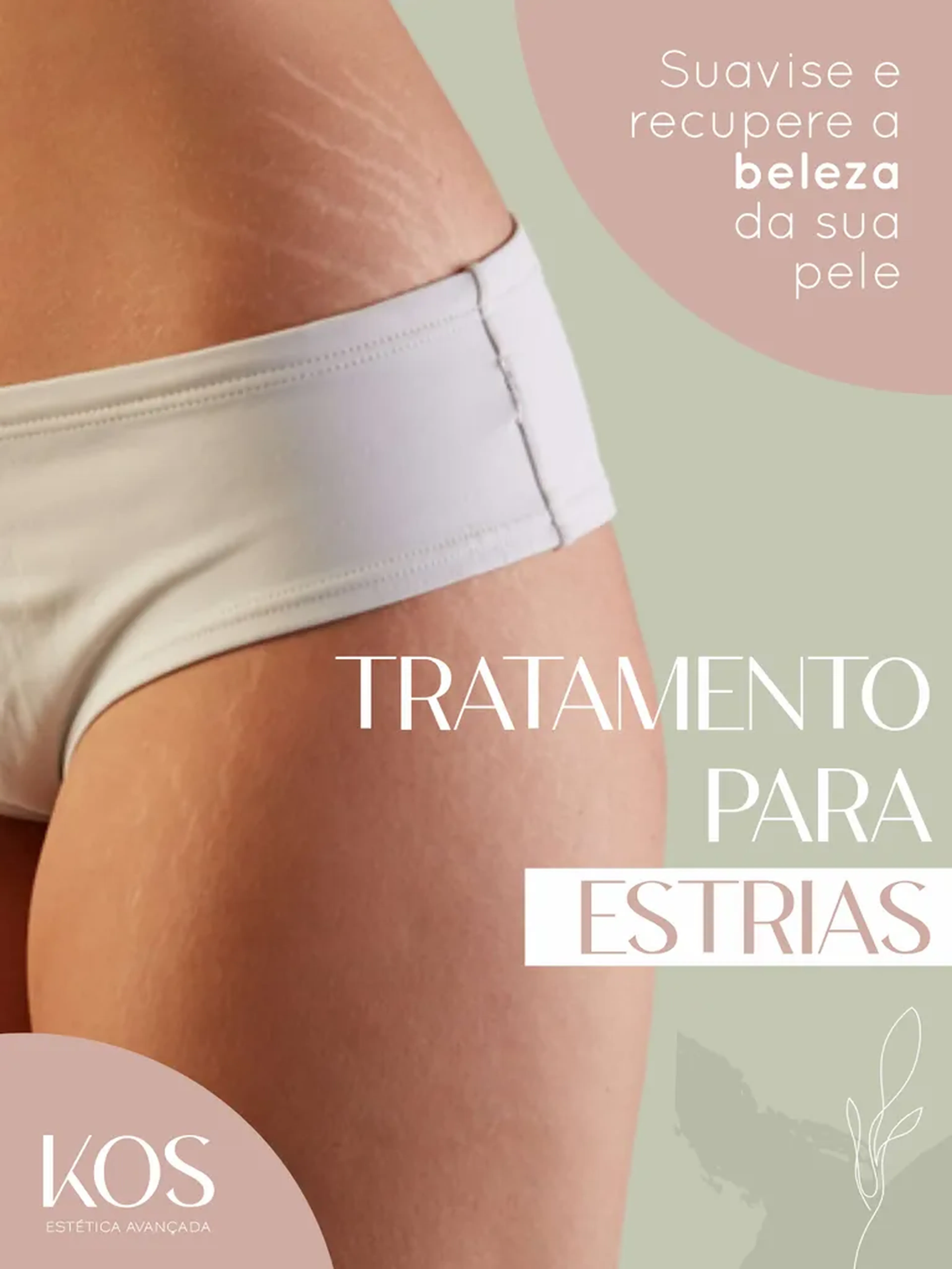 Estrias - Sessões Unitária imagem