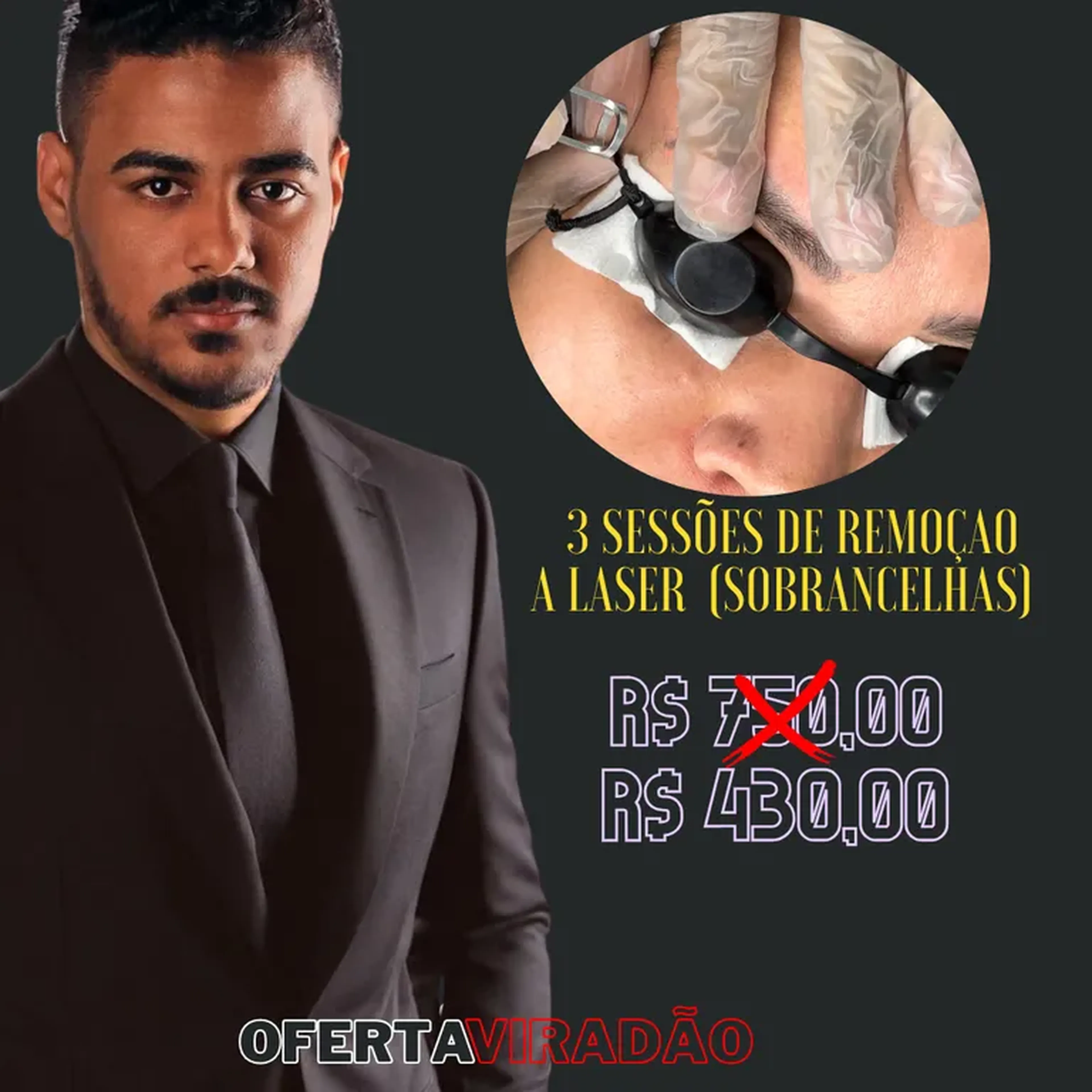 3 SESSÕES DE REMOÇÃO A LASER imagem