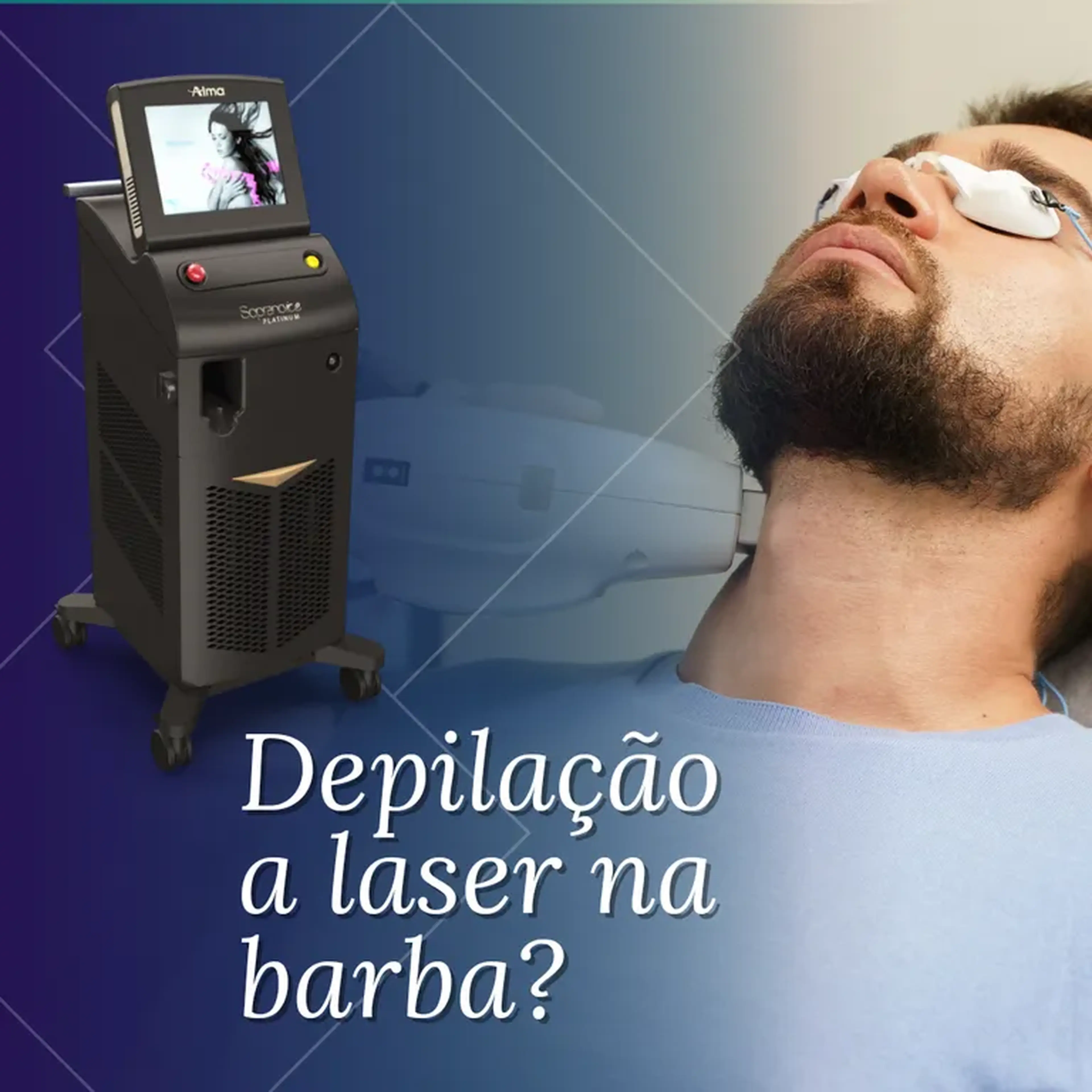 Depilação a Laser Barba imagem
