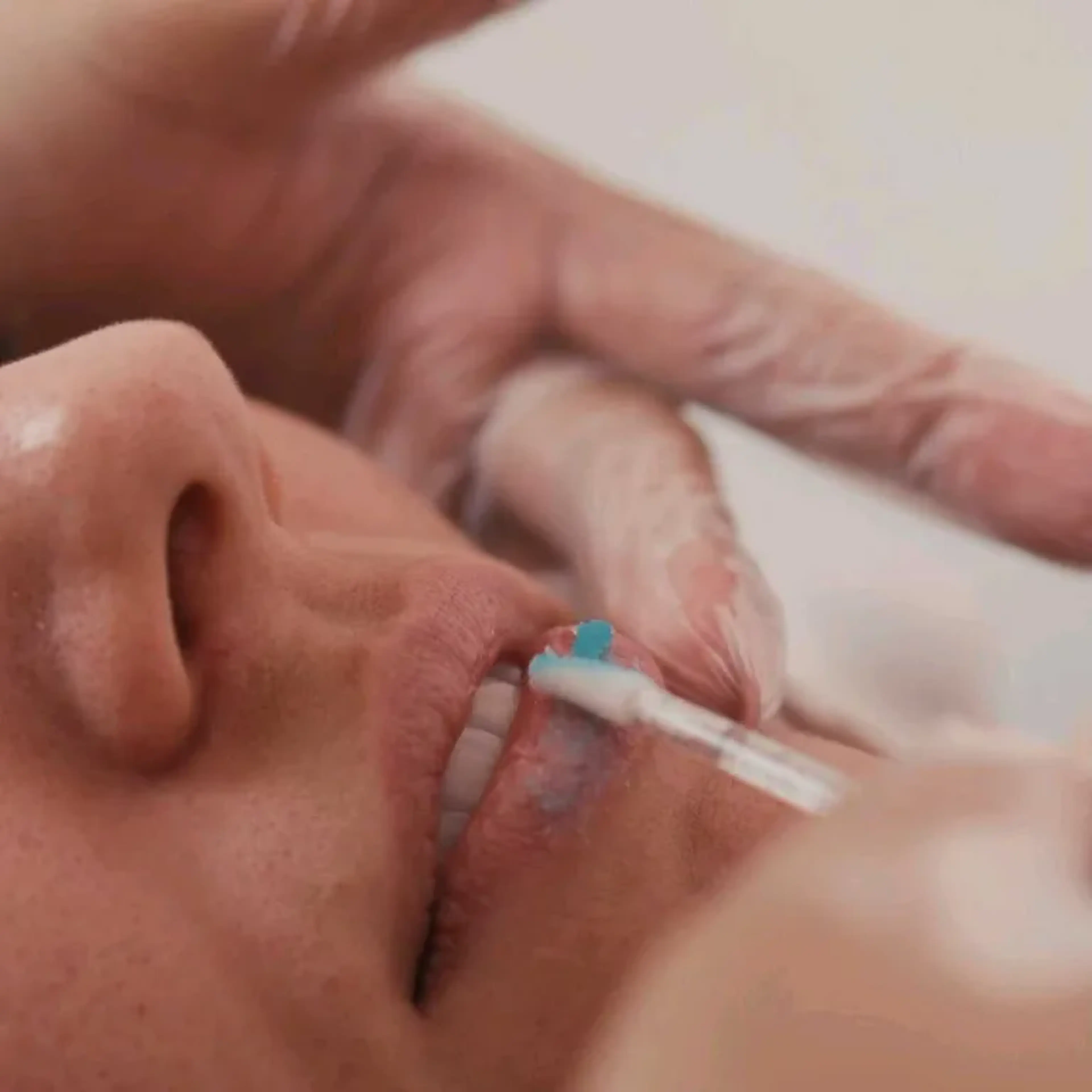 SoftLips imagem