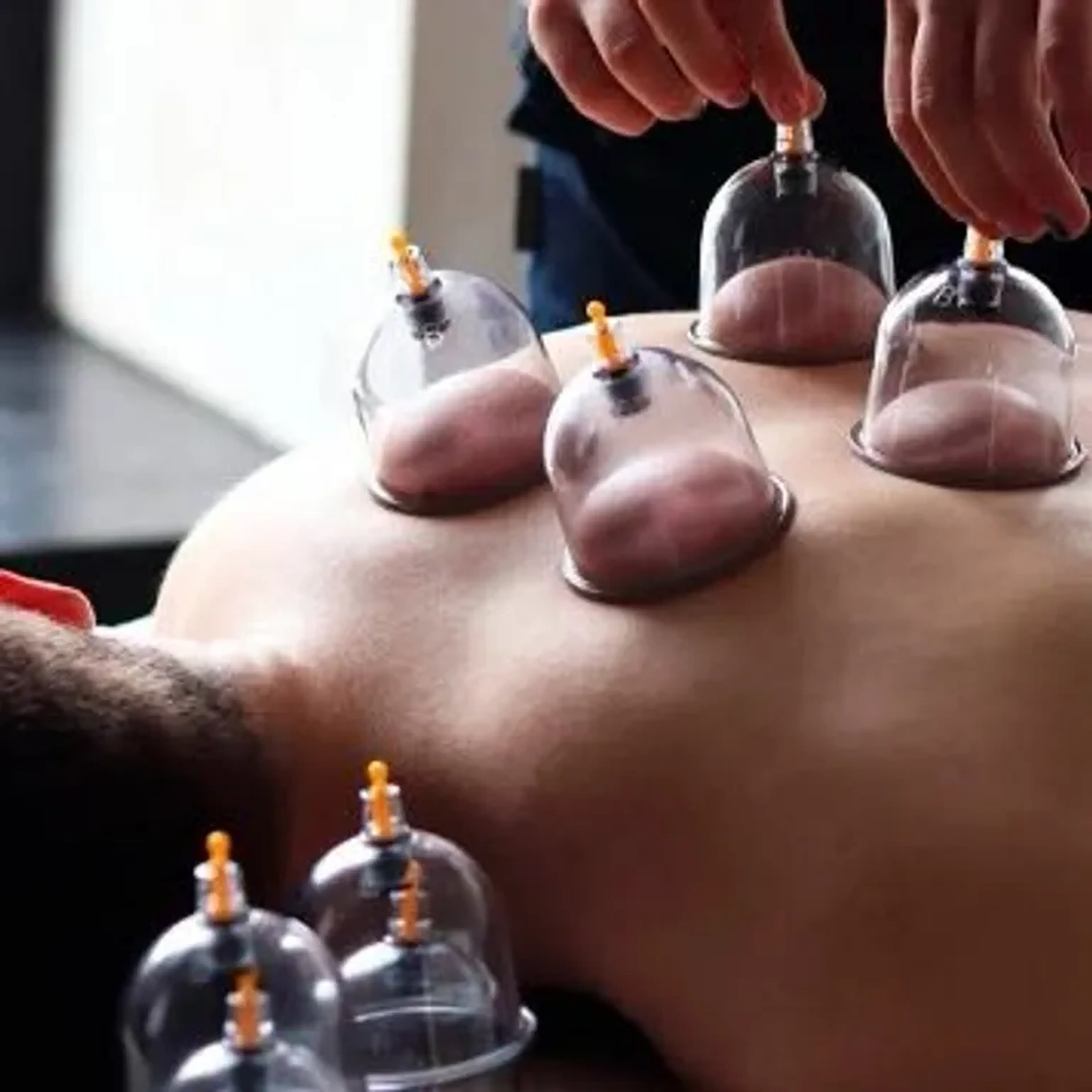 Curso de VentosaTerapia imagem