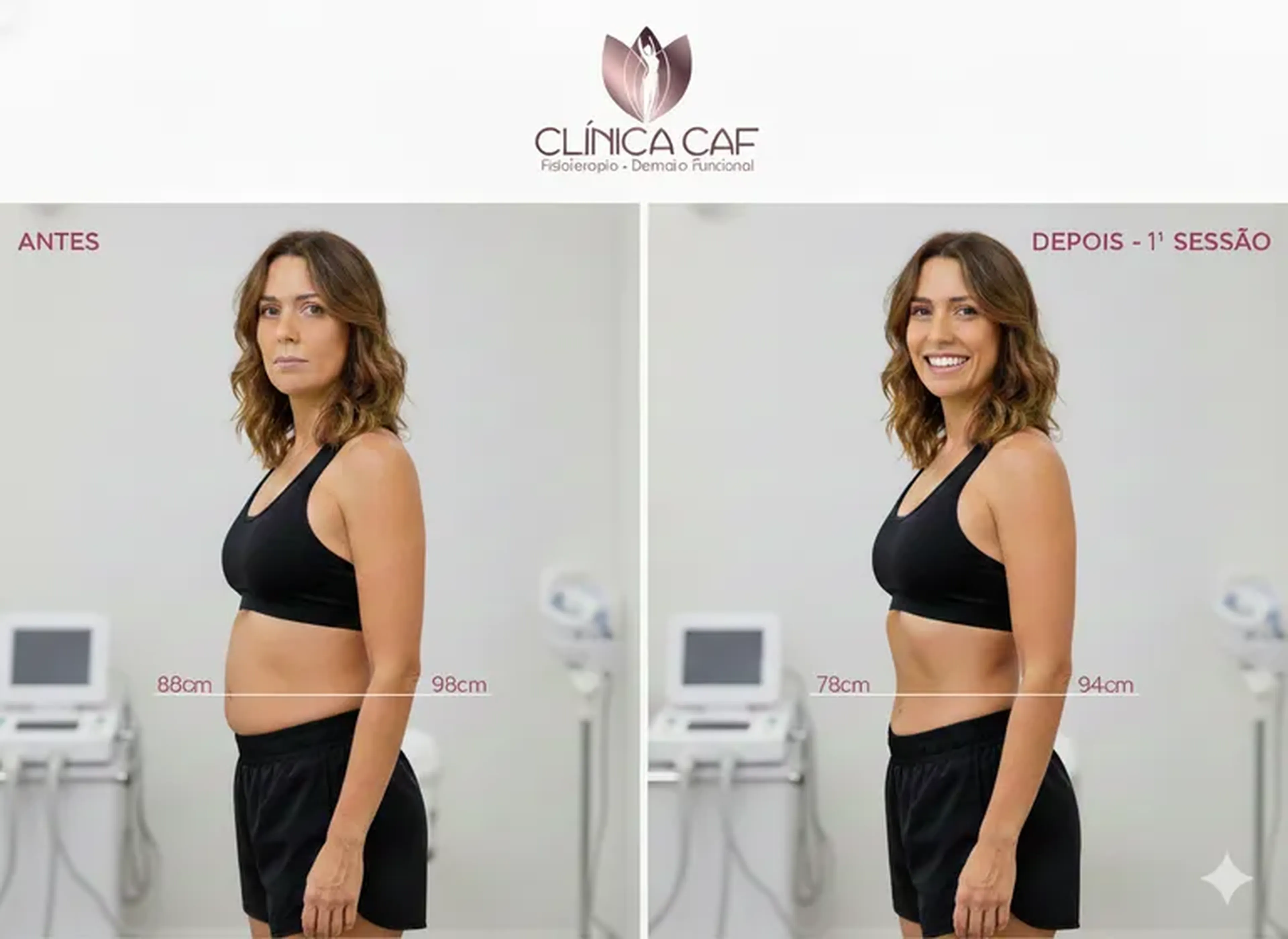 SECA BARRIGA 🔥12XRs 49,90. São 4 Super Sessões Oferta Pré-Natal imagem