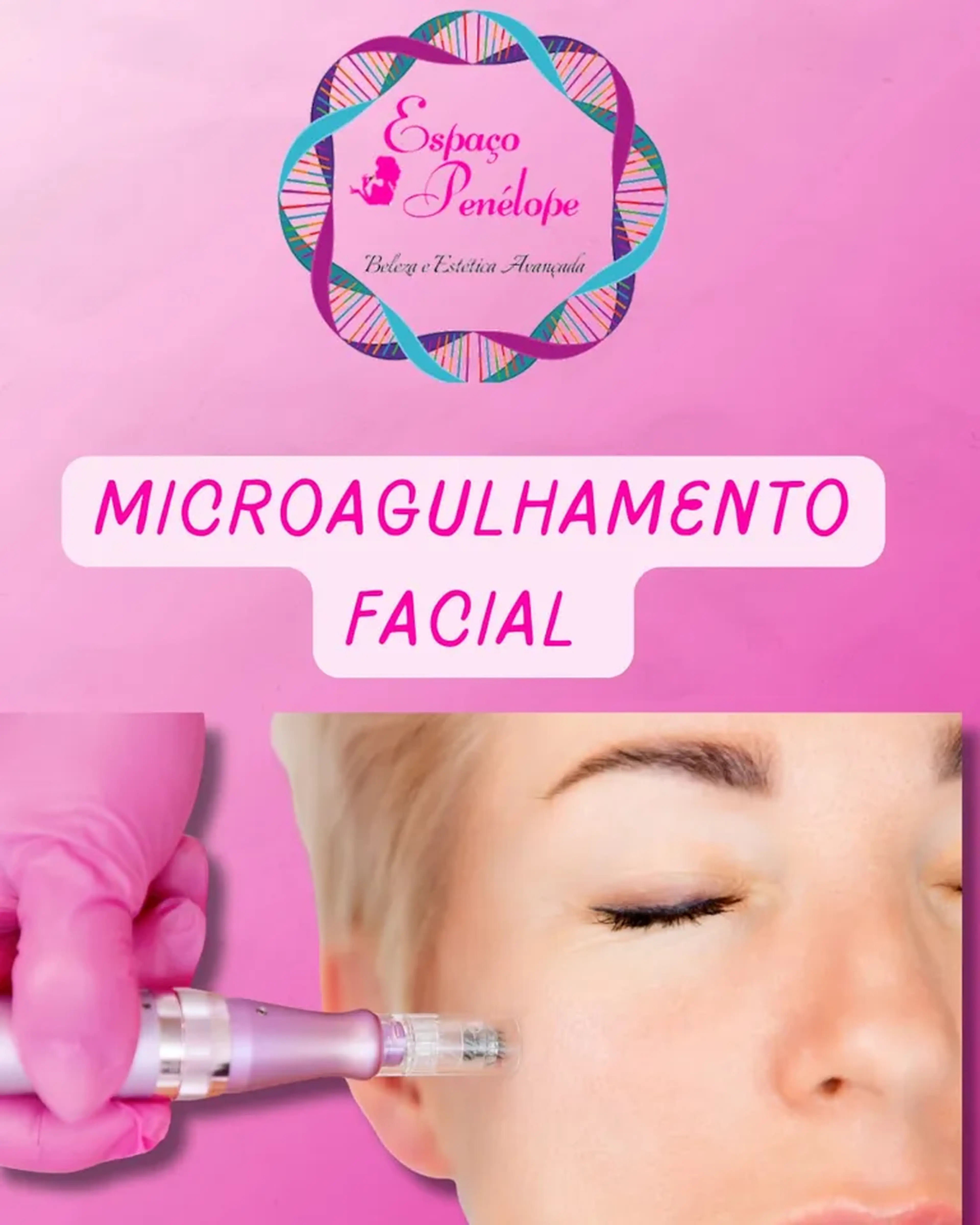 2 Sessões De Microagulhamento Na Vila Mariana imagem