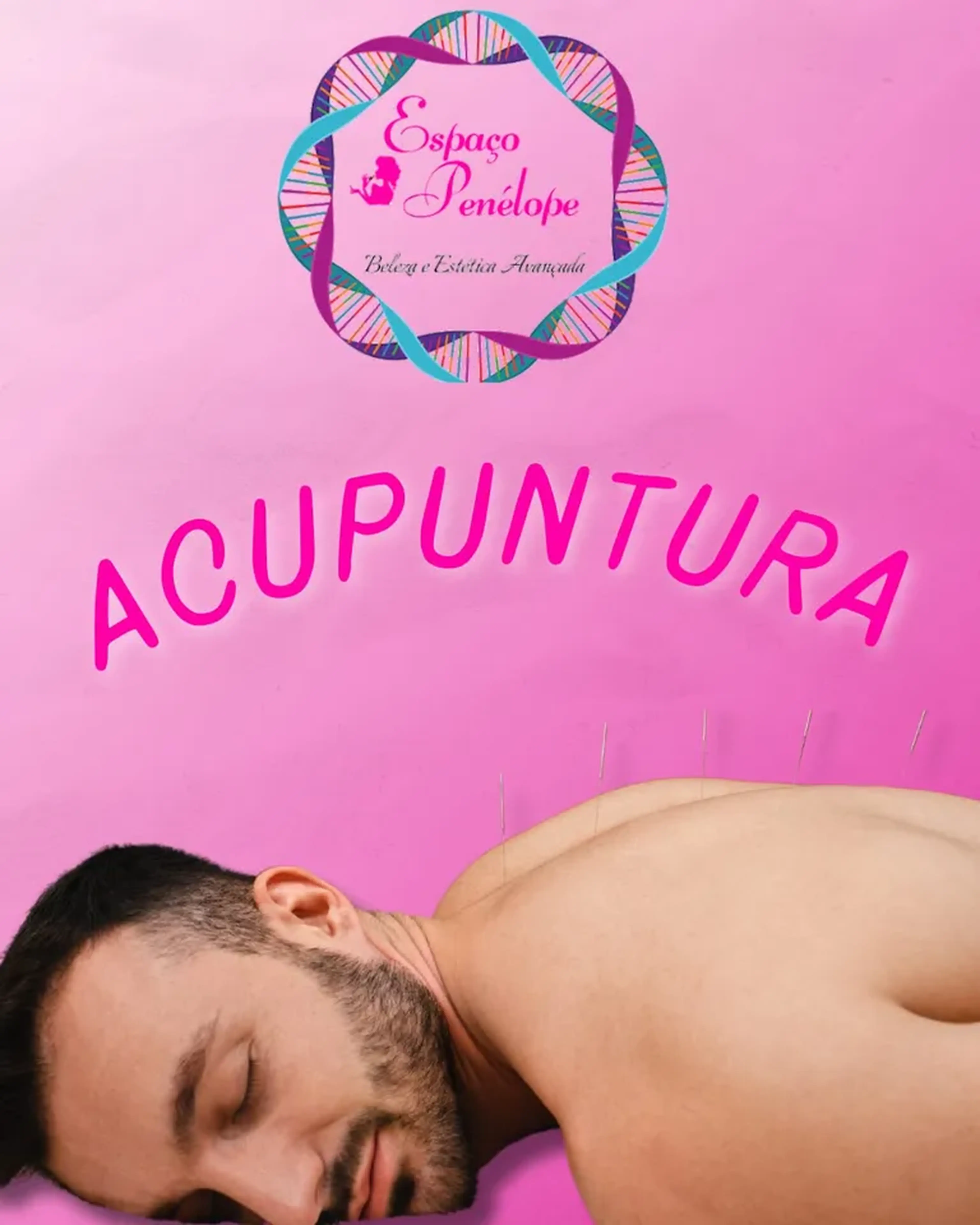1 Sessão De Acupuntura Na Vila Mariana imagem