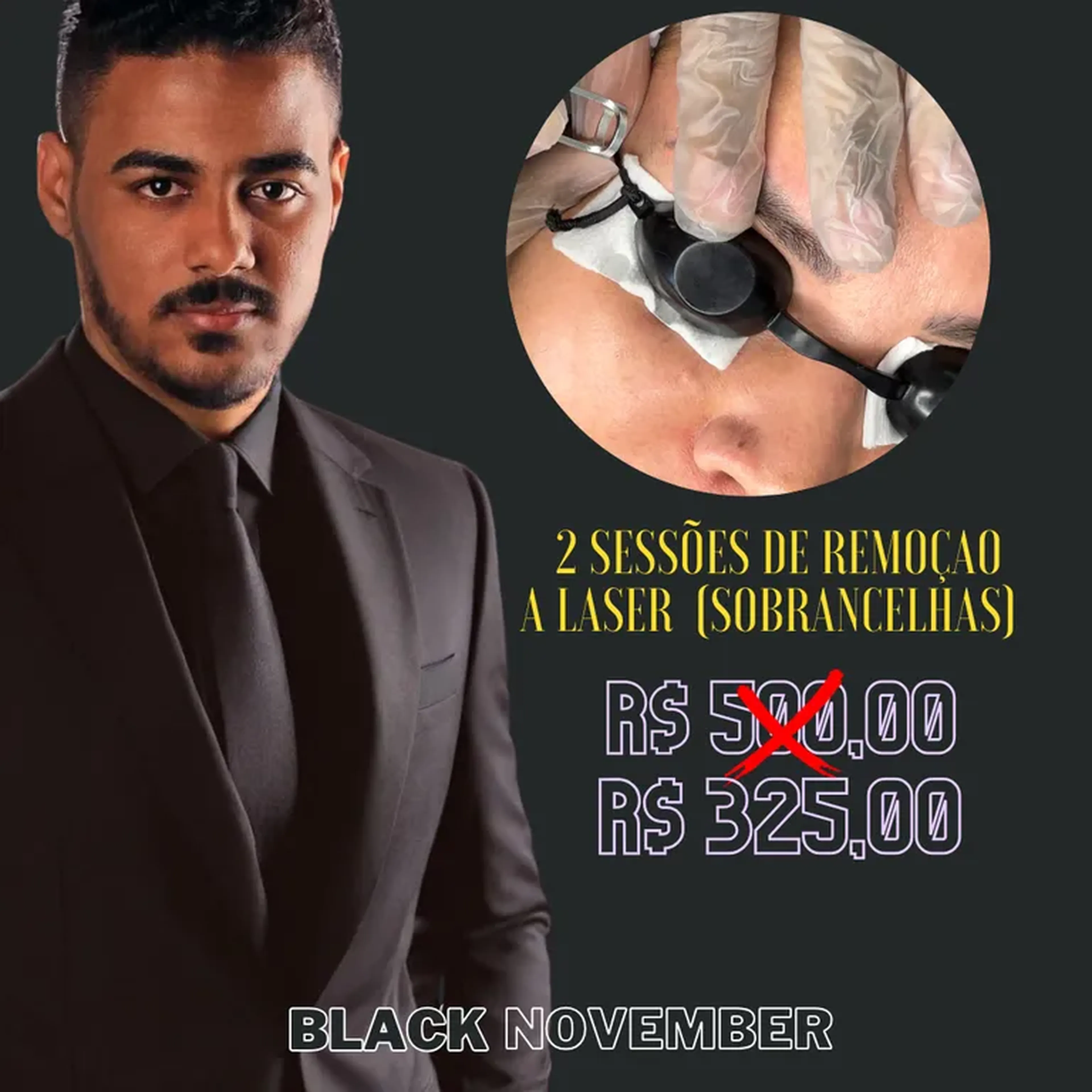 2 SESSÕES DE REMOÇÃ A LASER imagem