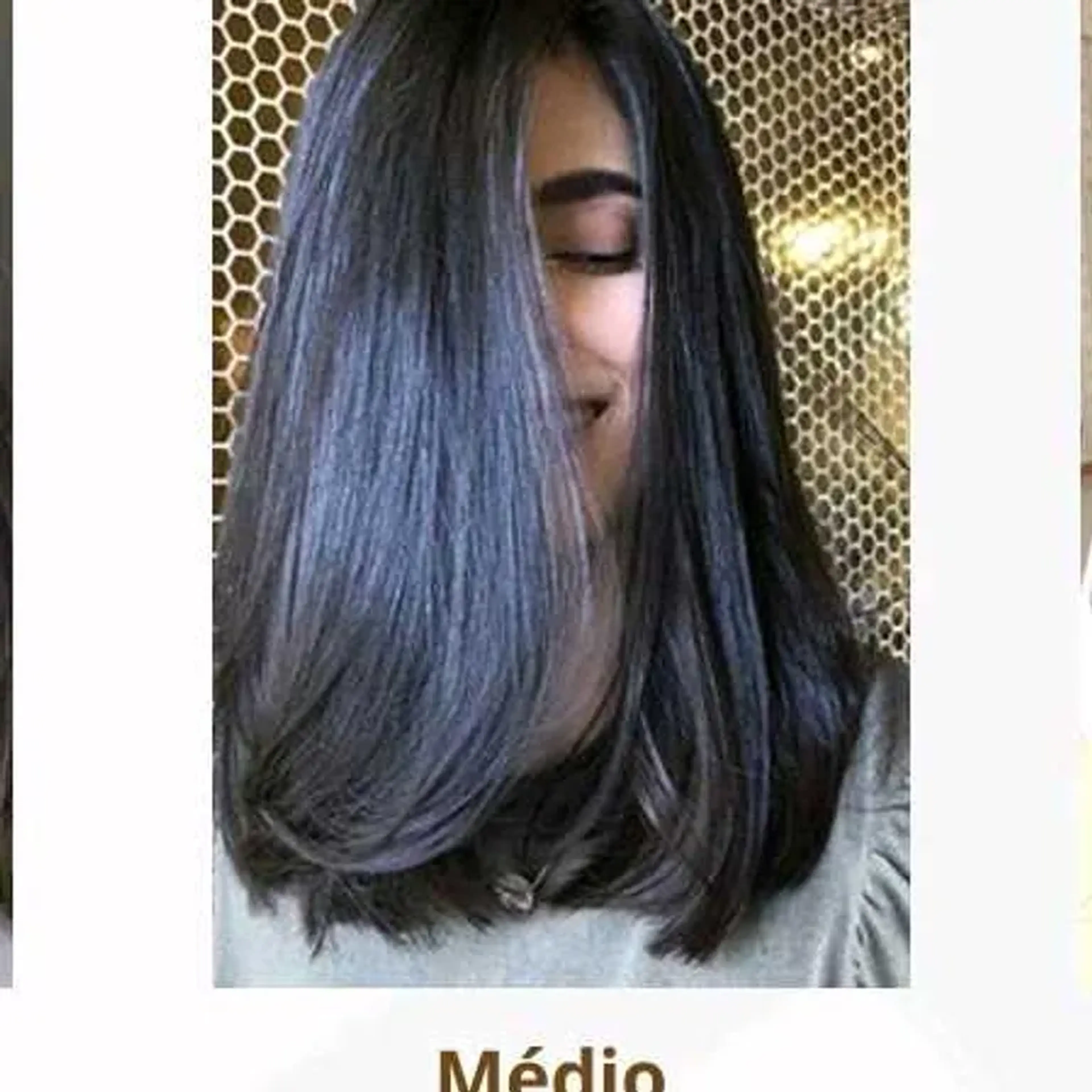 2. Botox Médio imagem