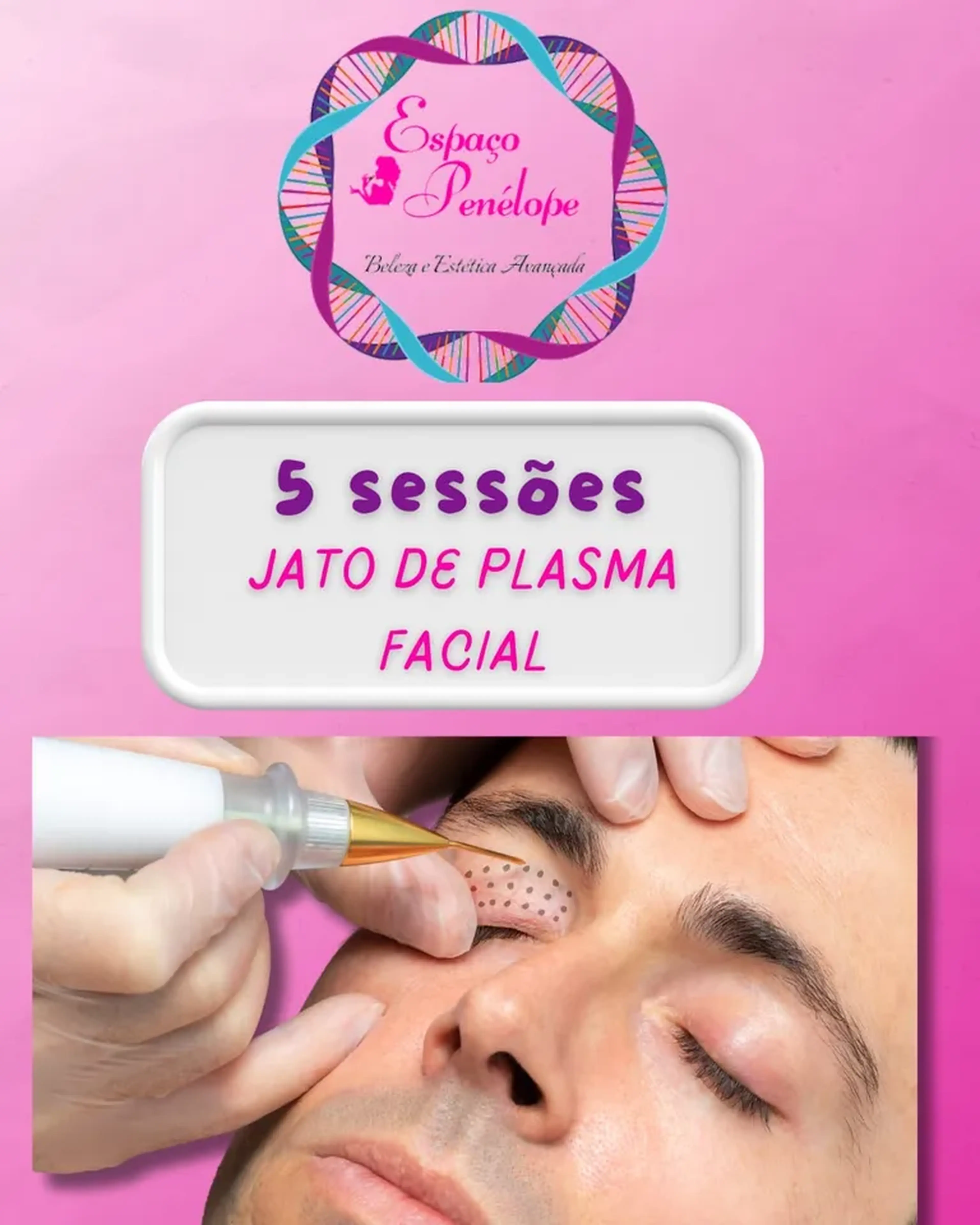 5 Sessões De Jato De Plasma Facial na Vila Mariana imagem