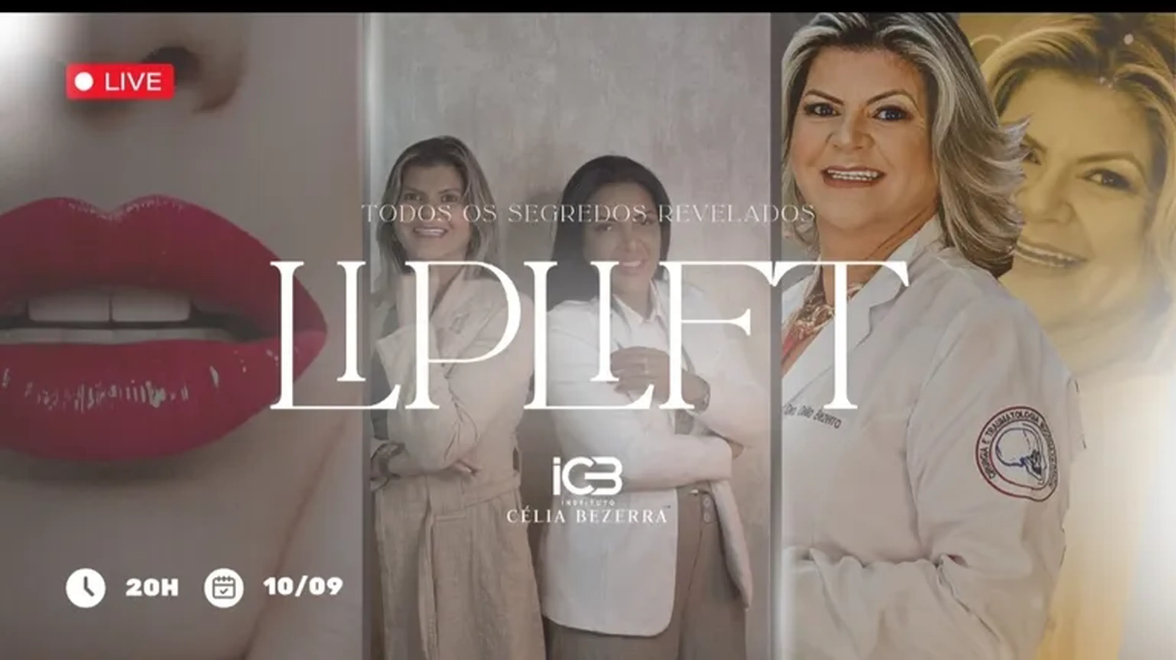 Mentoria de Lip lift imagem