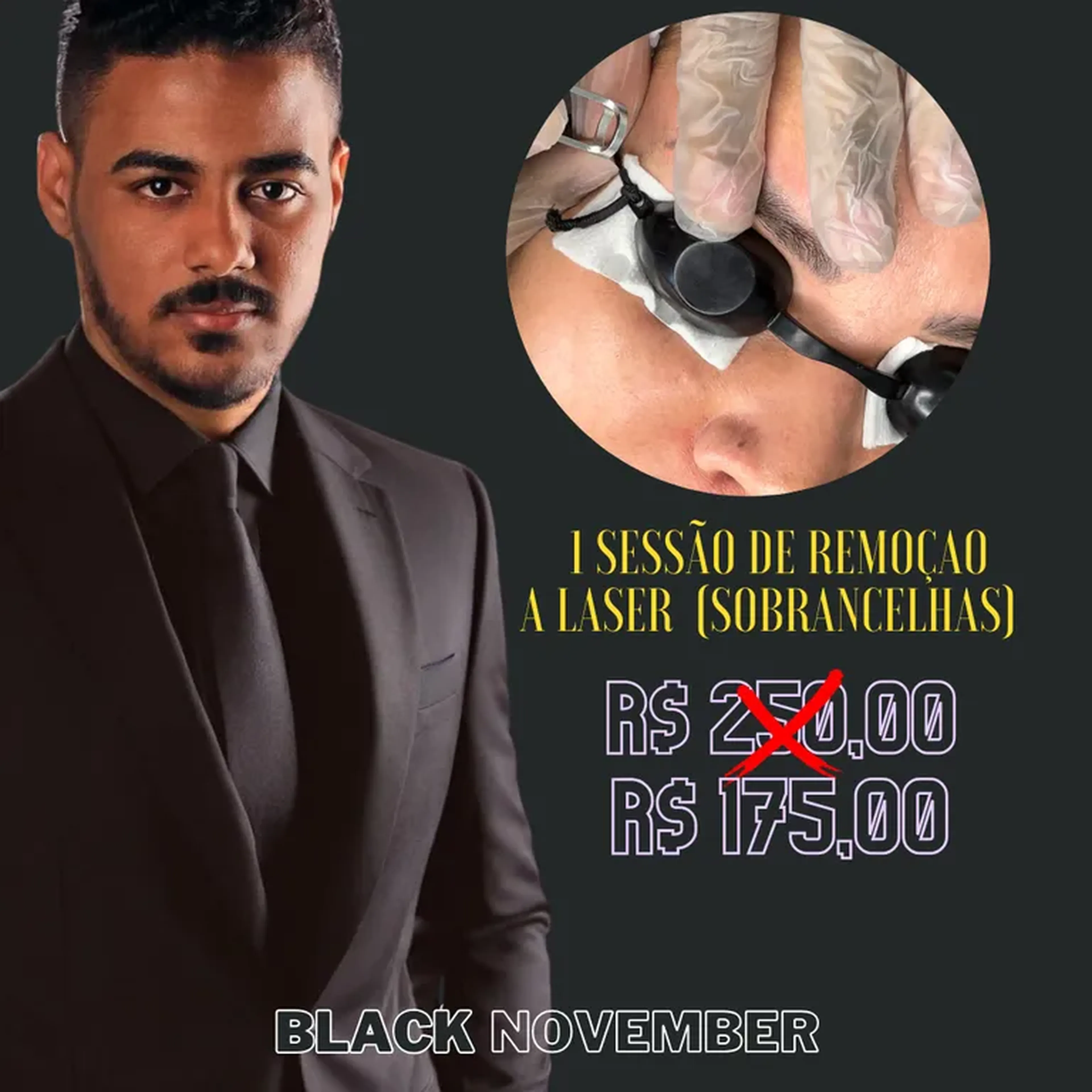 1 SESSÃO DE REMOÇÃOA LASER imagem