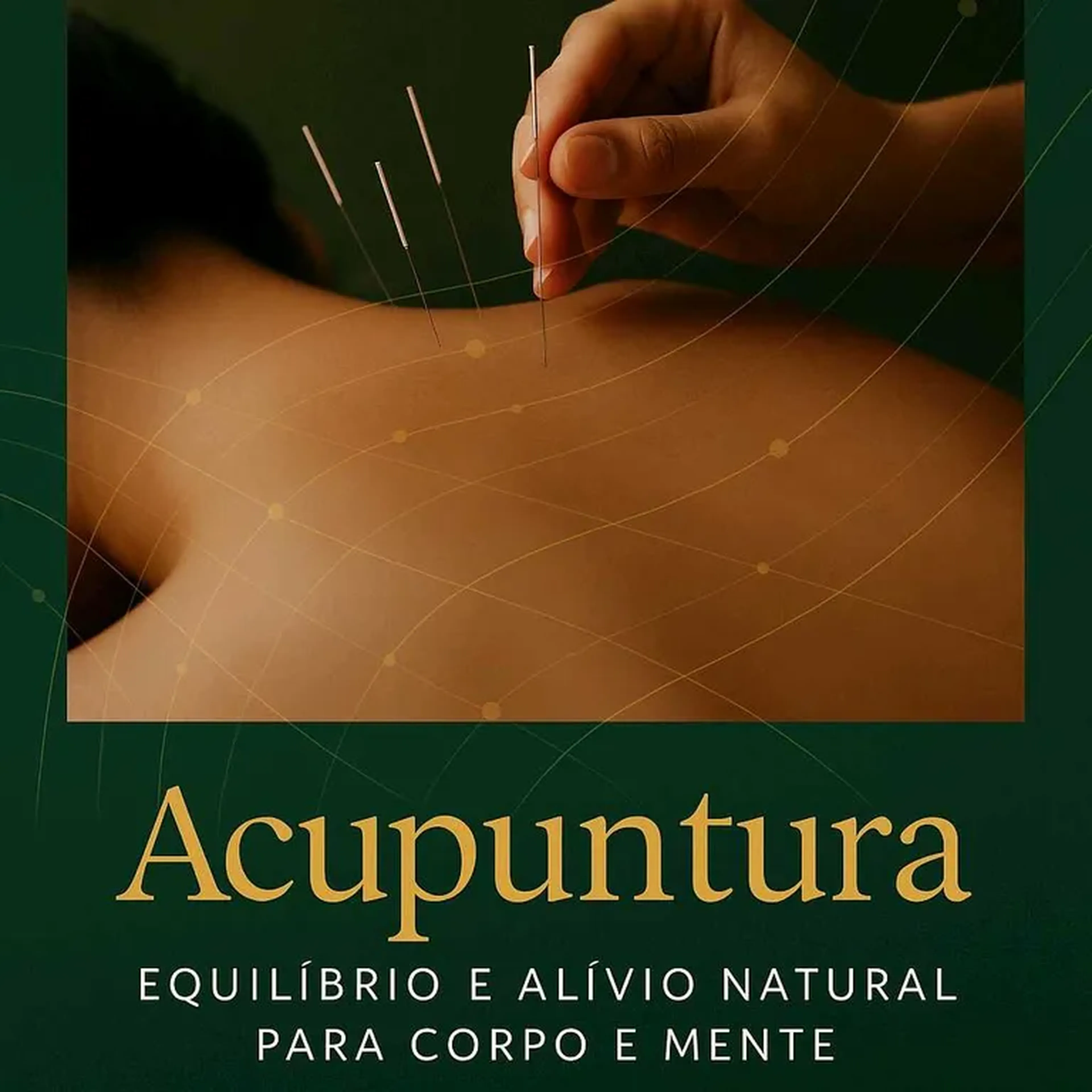 Acupuntura equilíbrio sistêmica imagem