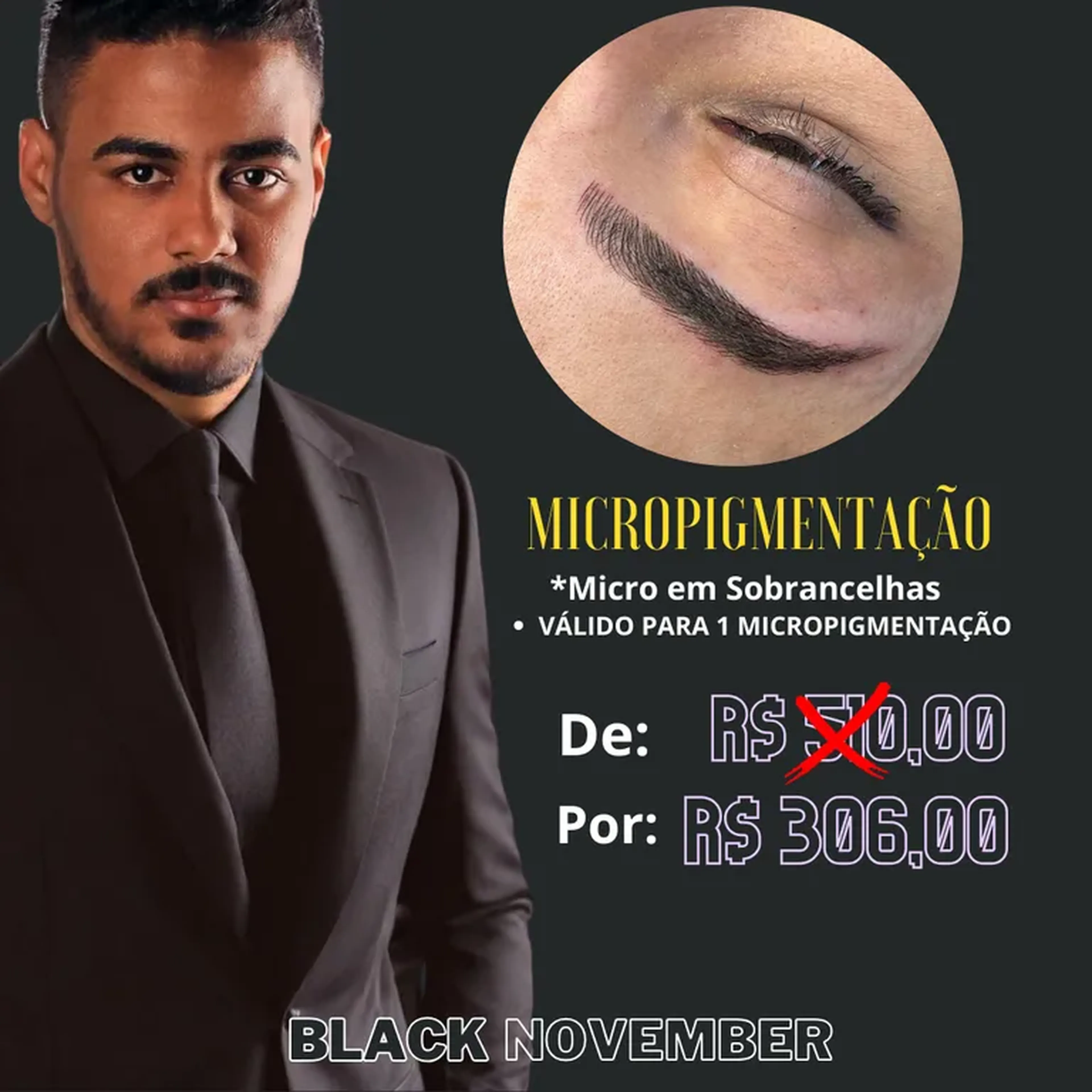 1 MICROPIGMENTAÇÃO imagem