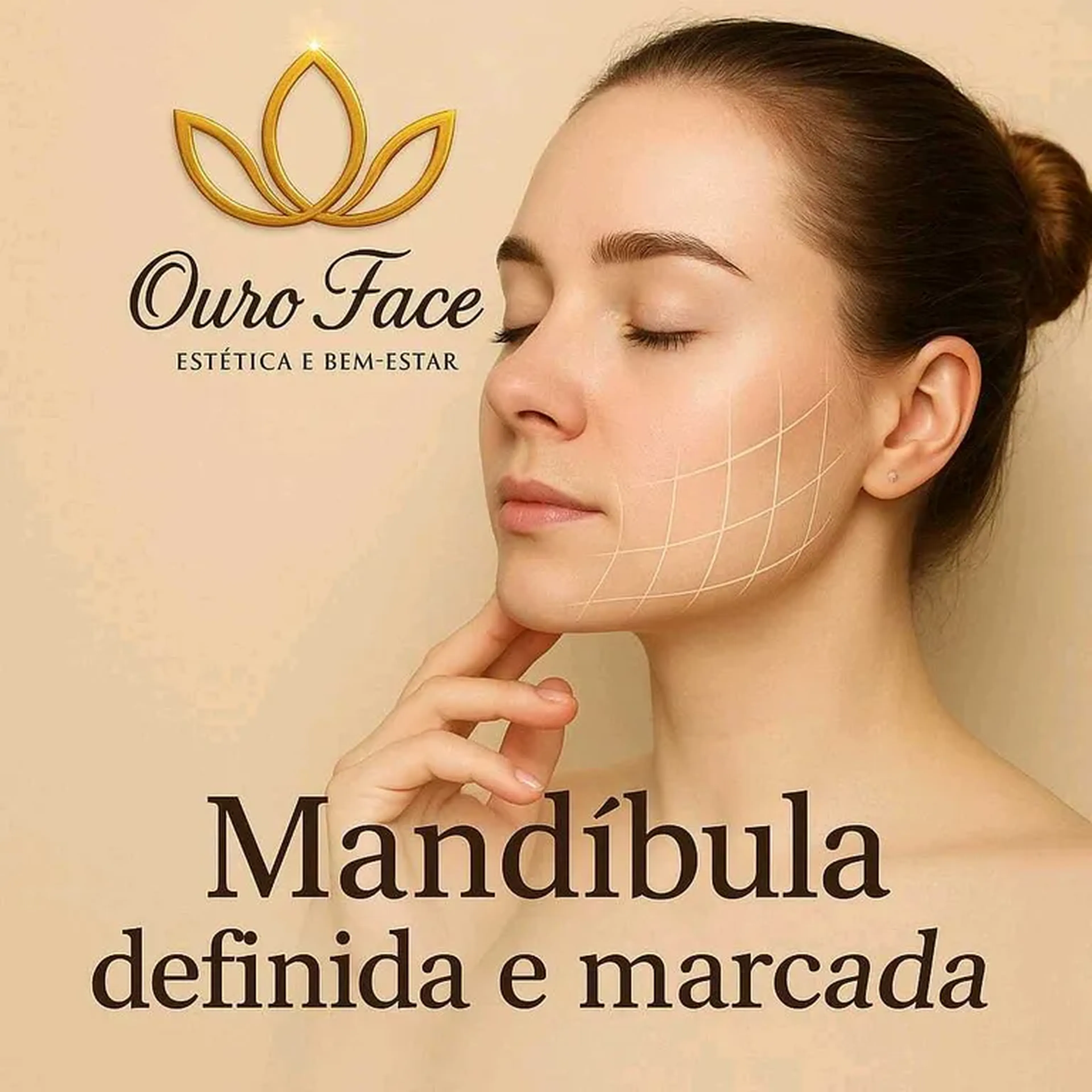 PREENCHIMENTO MENTO(1ml) imagem