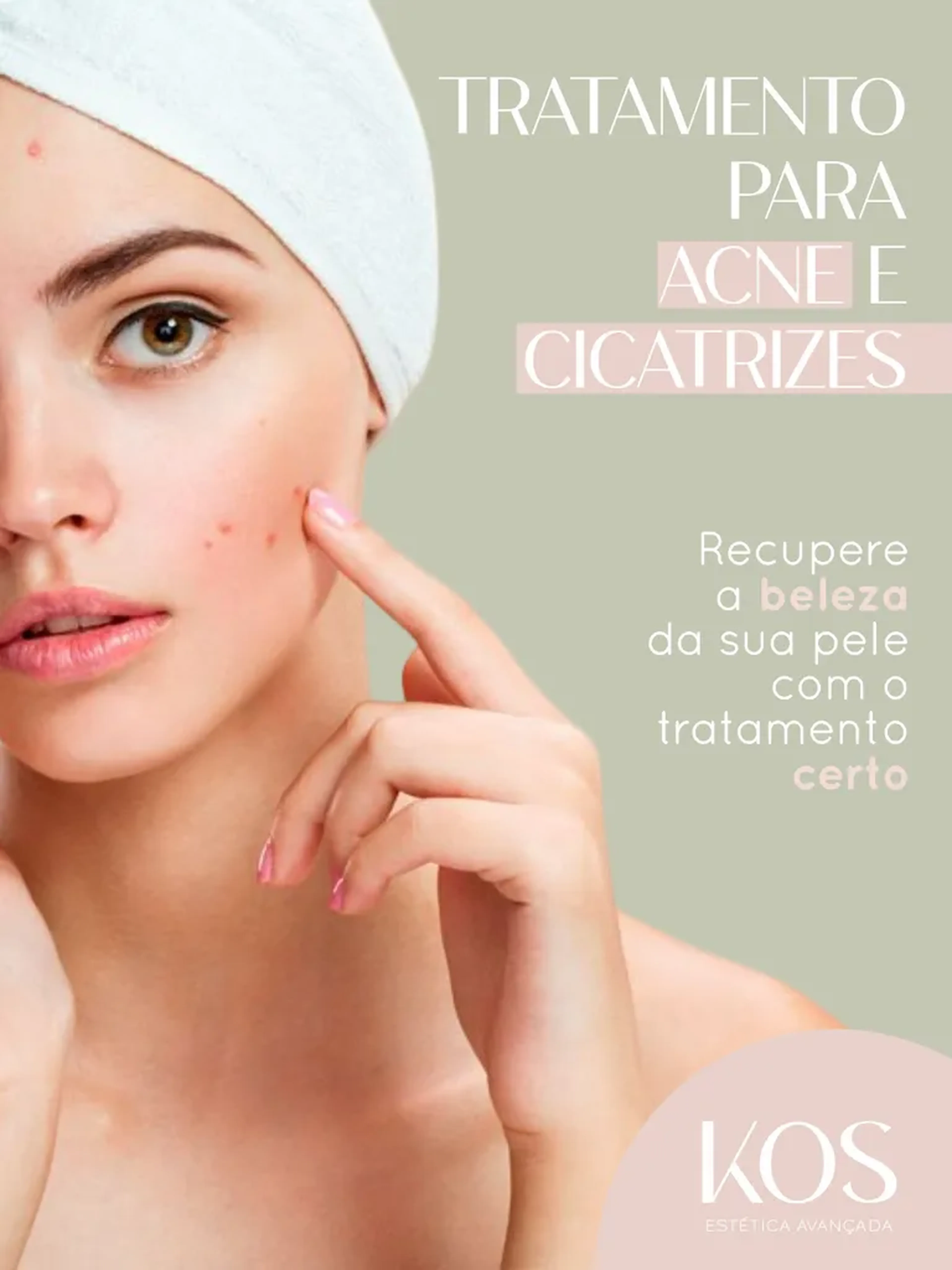 Acne - Sessão Unitária imagem