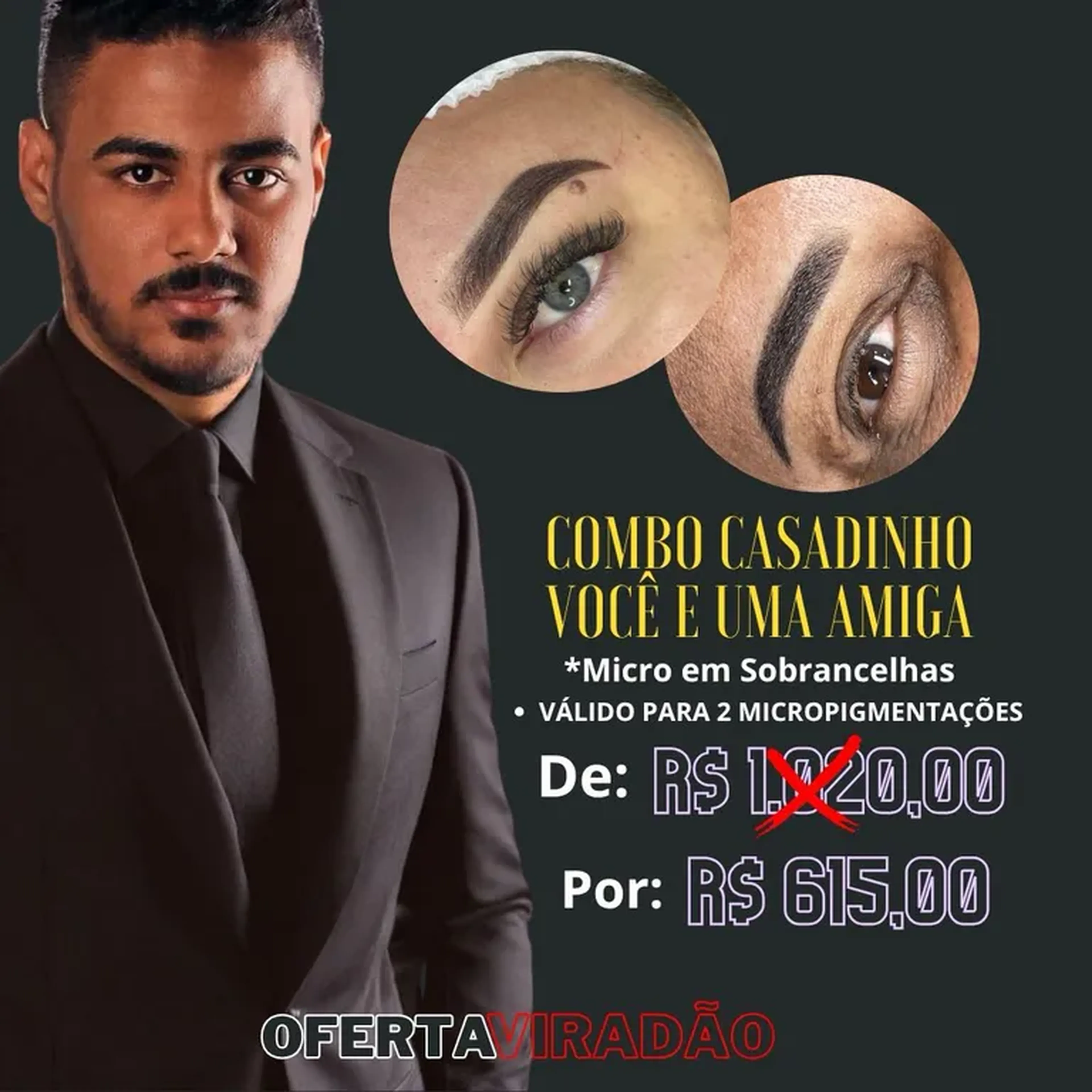 2 MICROPIGMENTACÕES imagem