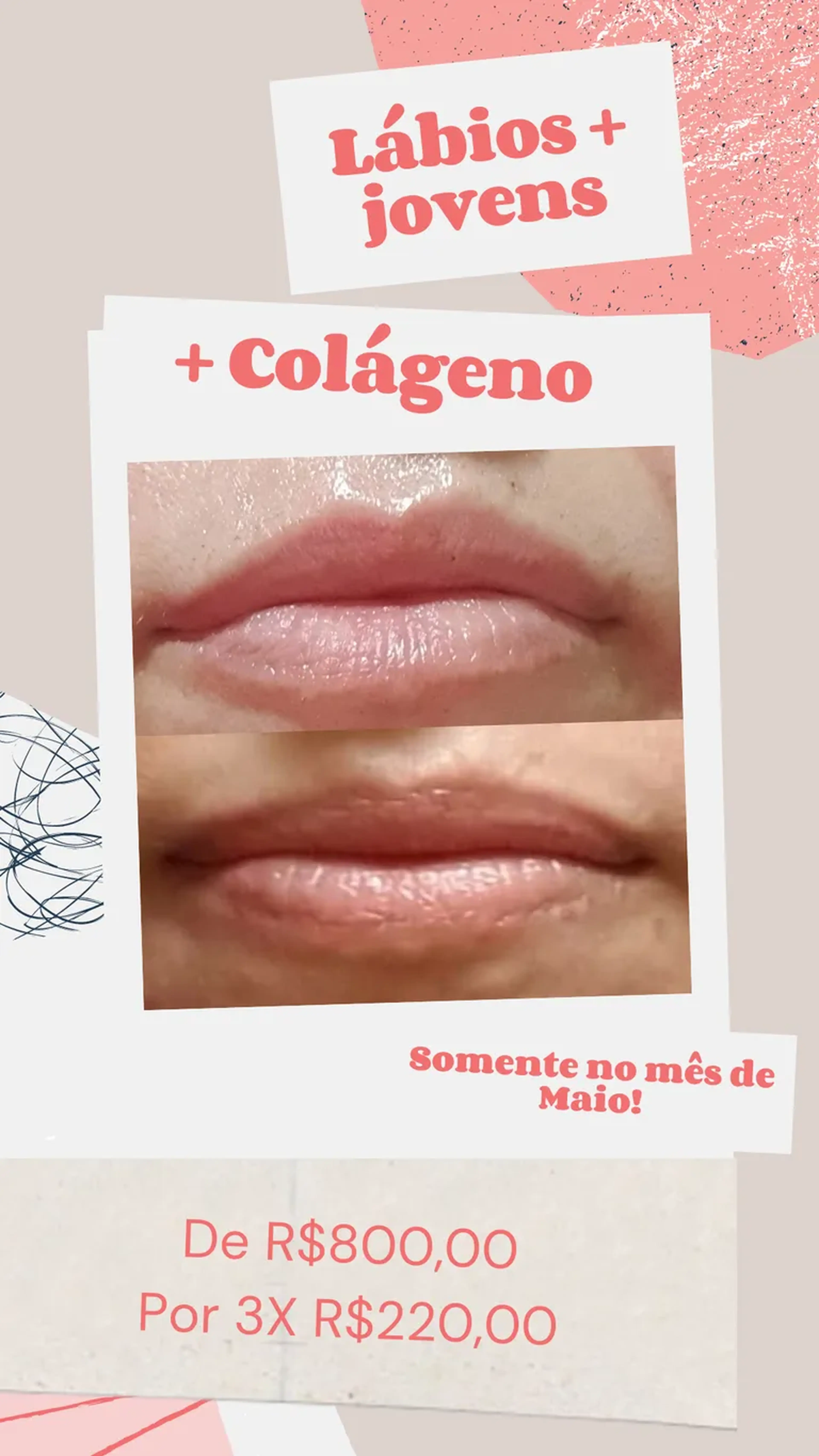 Renove Lips imagem