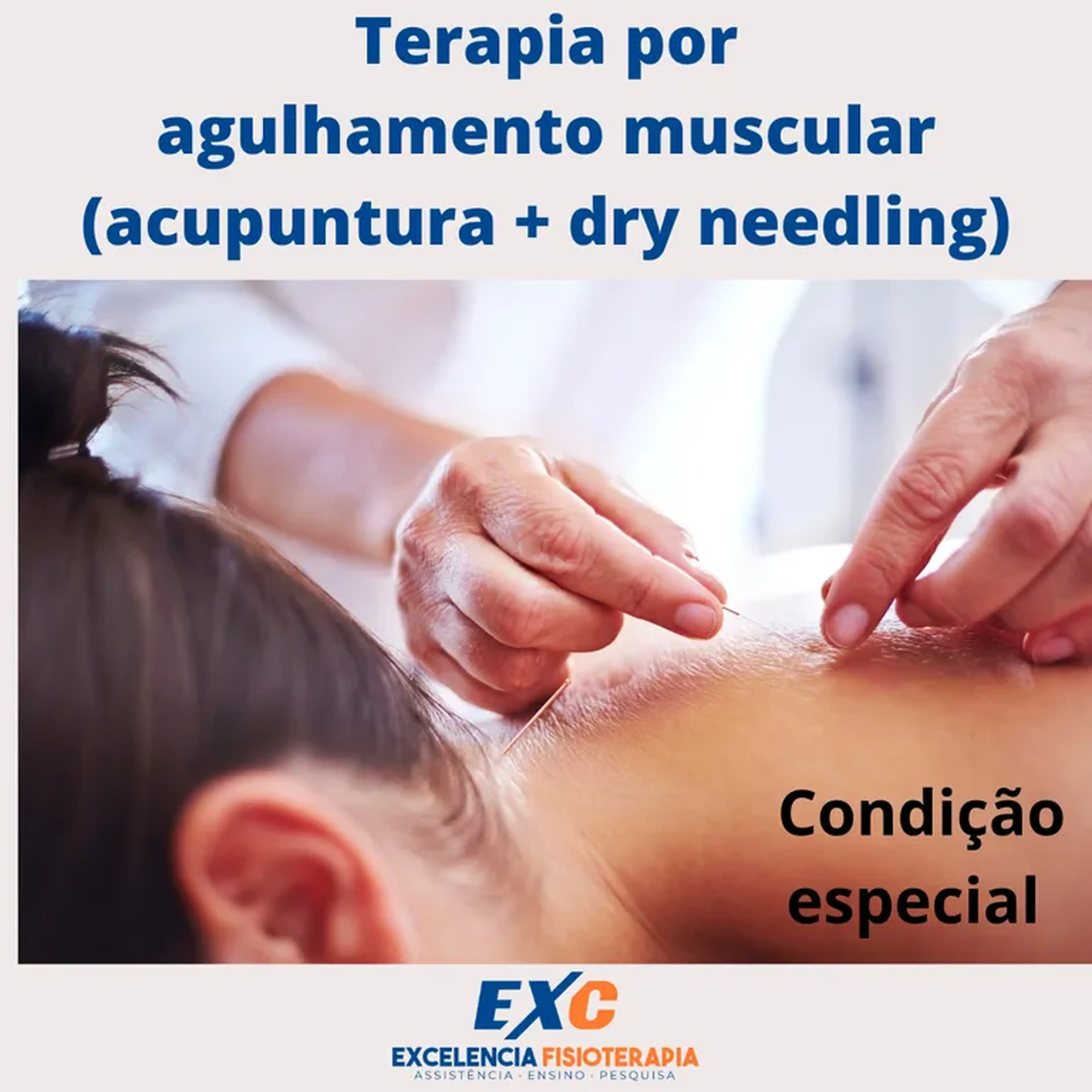 Terapia por agulhamento muscular imagem