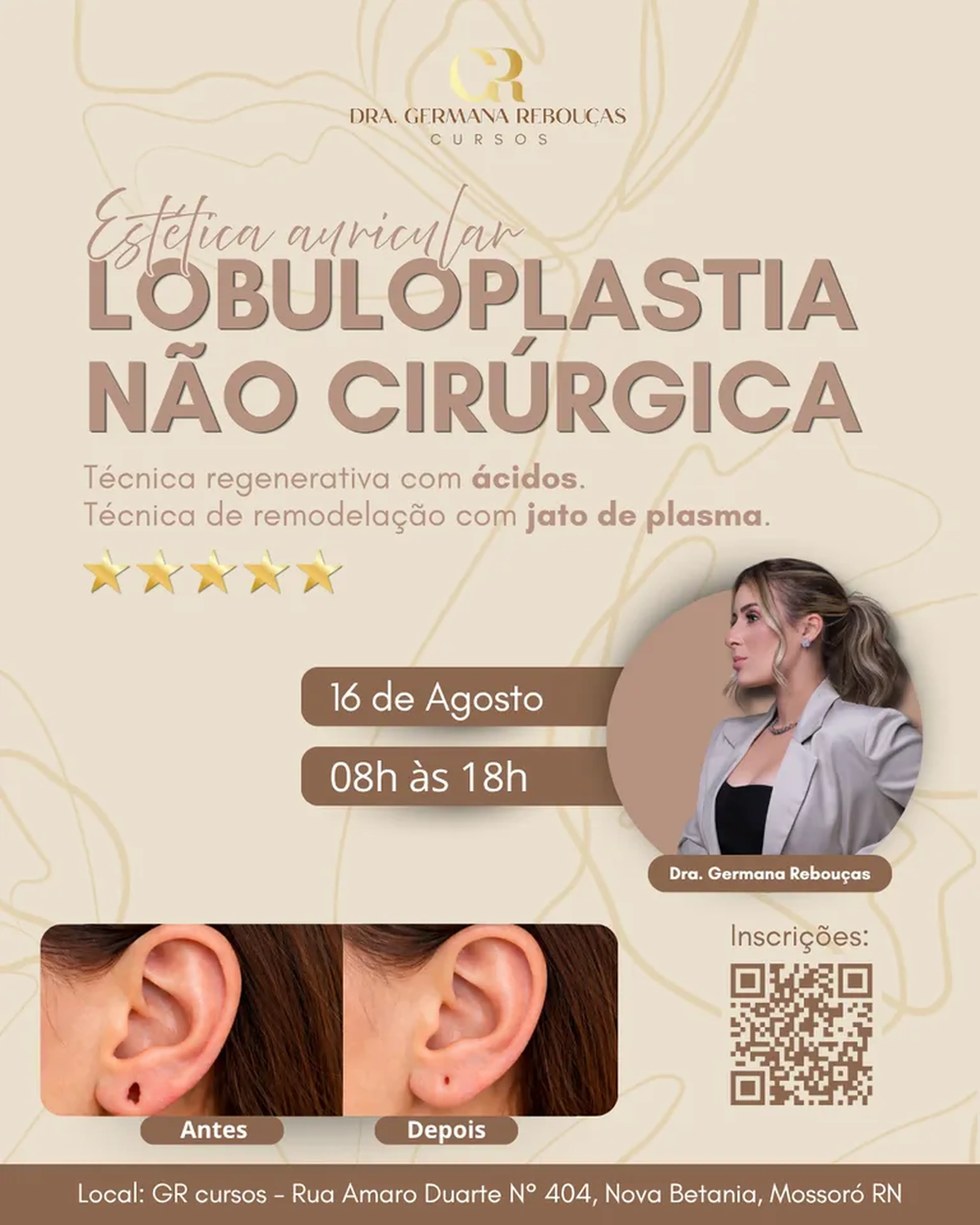 Lobuloplastia não cirúrgica imagem