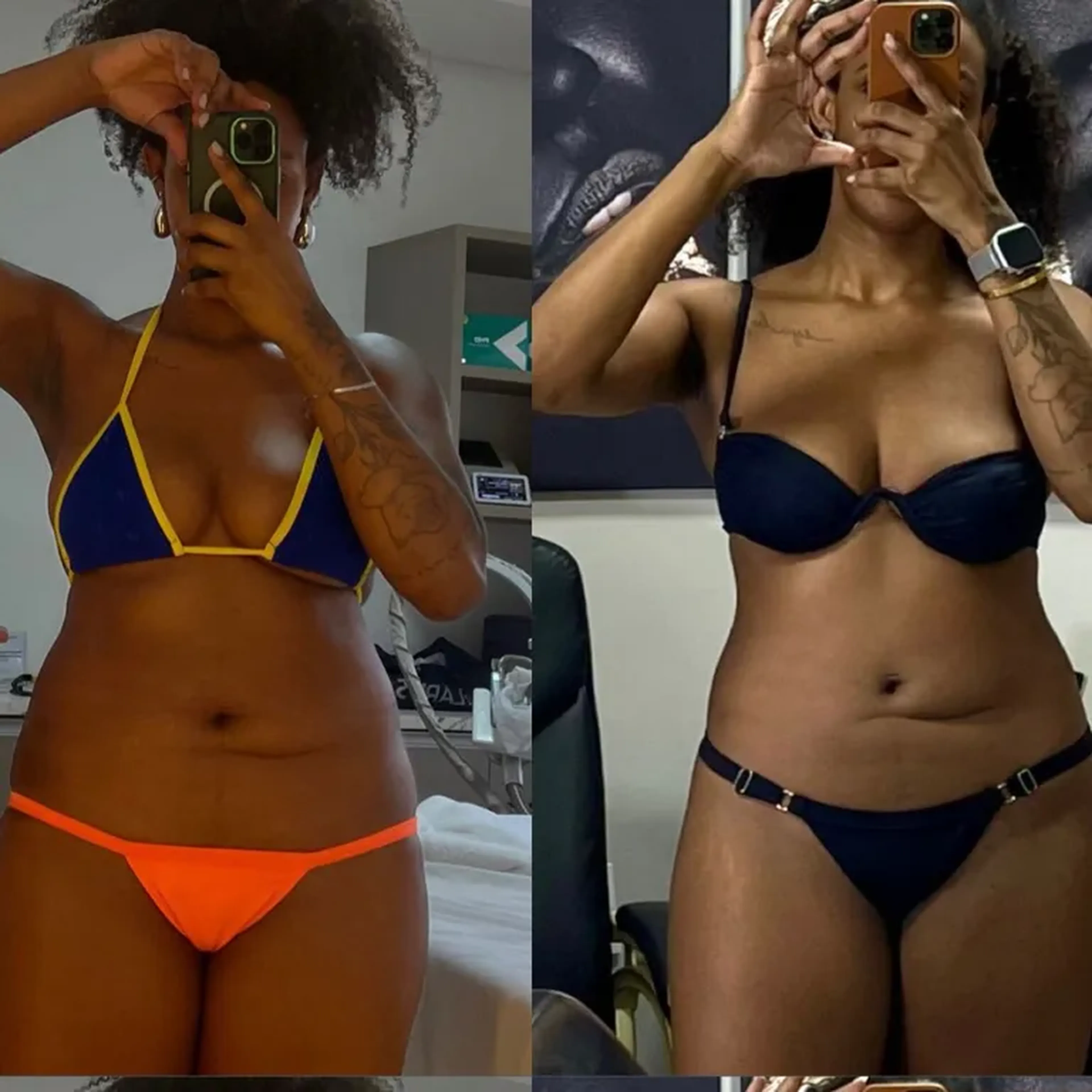 COMBO VERÃO imagem