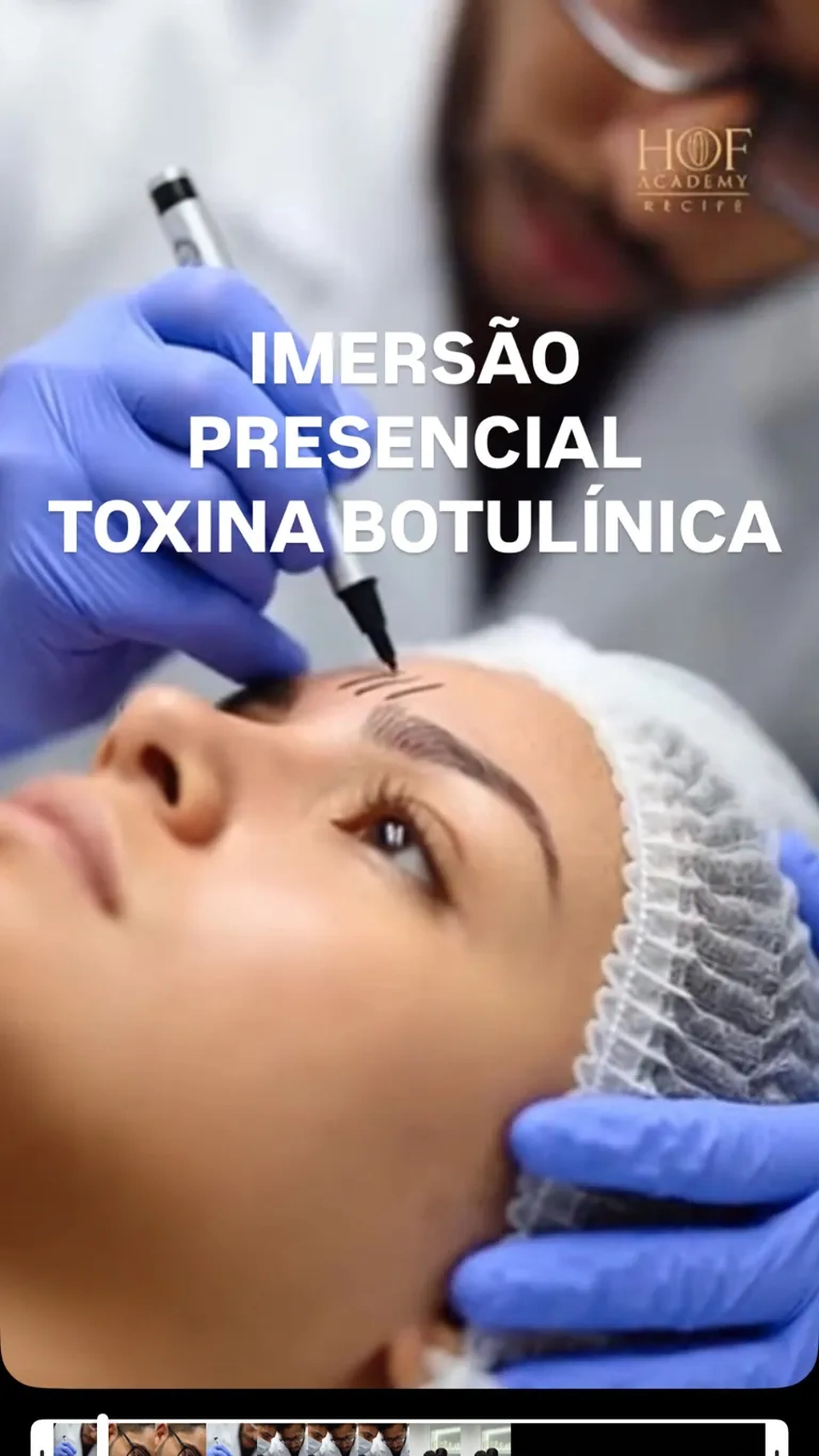 Imersão Presencial Toxina Botulínica BASIC HOF -COMECE POR AQUI imagem