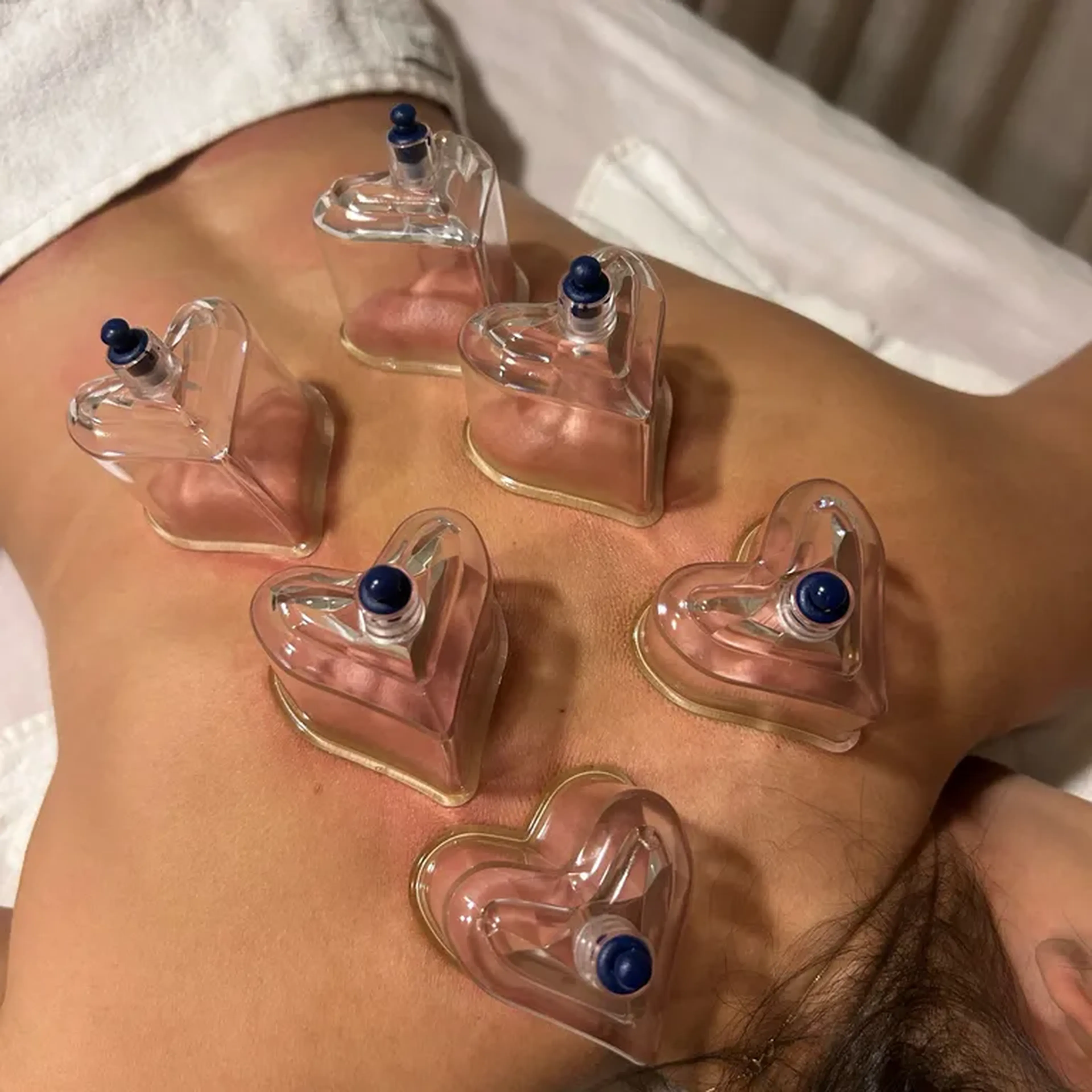 Massagem Terapêutica e Ventosaterapia imagem