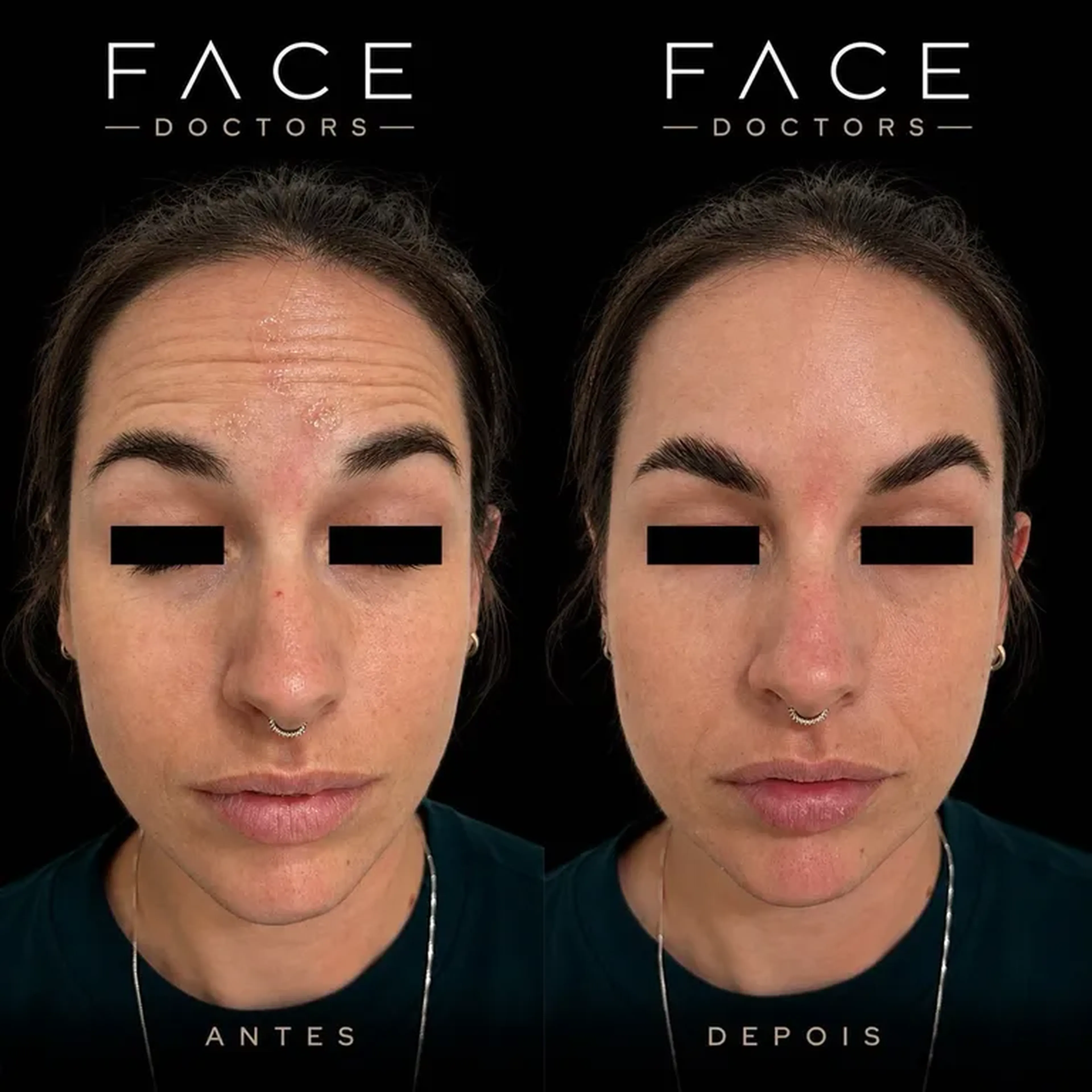 Full Face Exclusive individual imagem