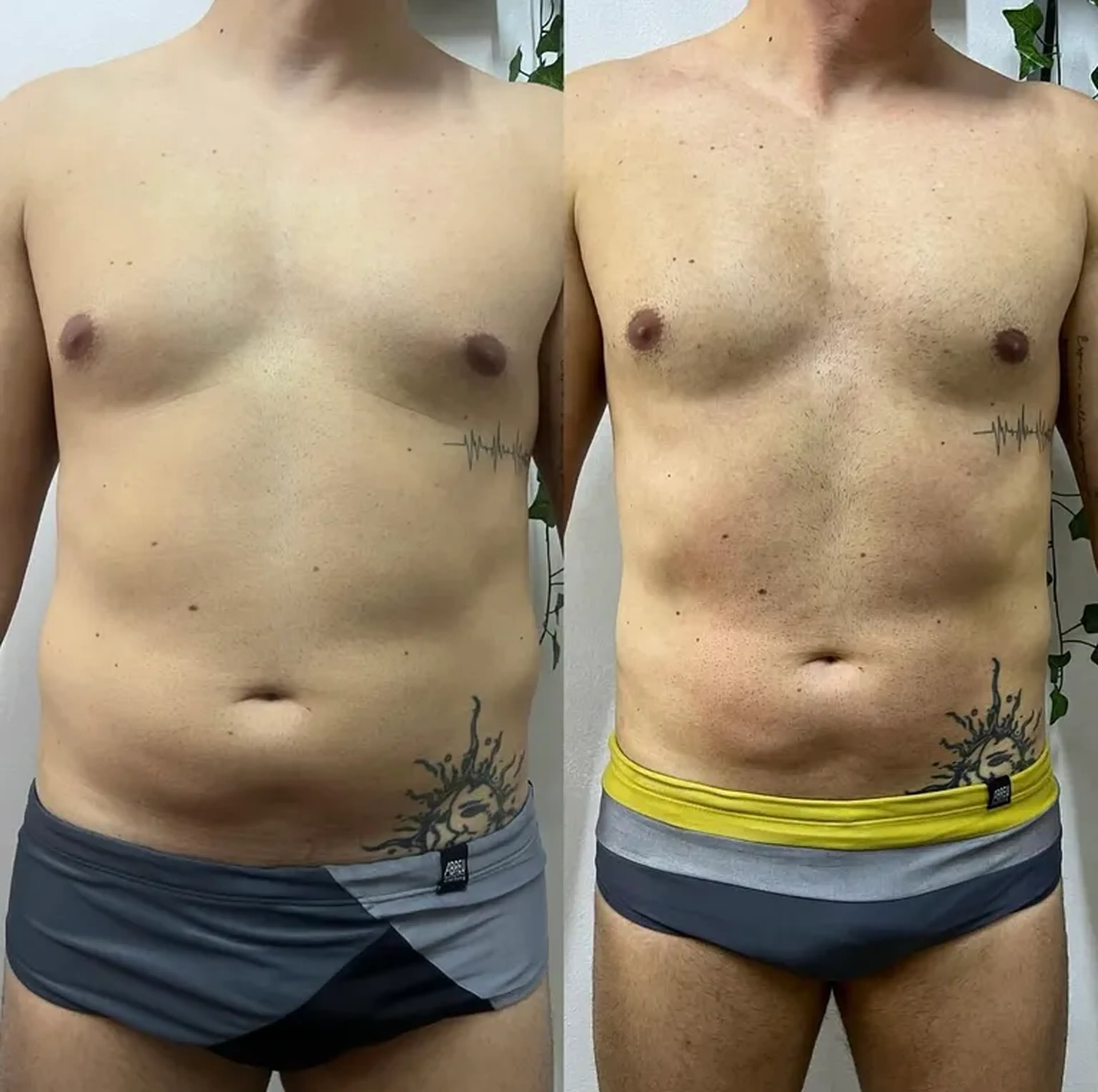 Enzimas Esvaziadores de Gordura Localizada + Massagem corporal imagem