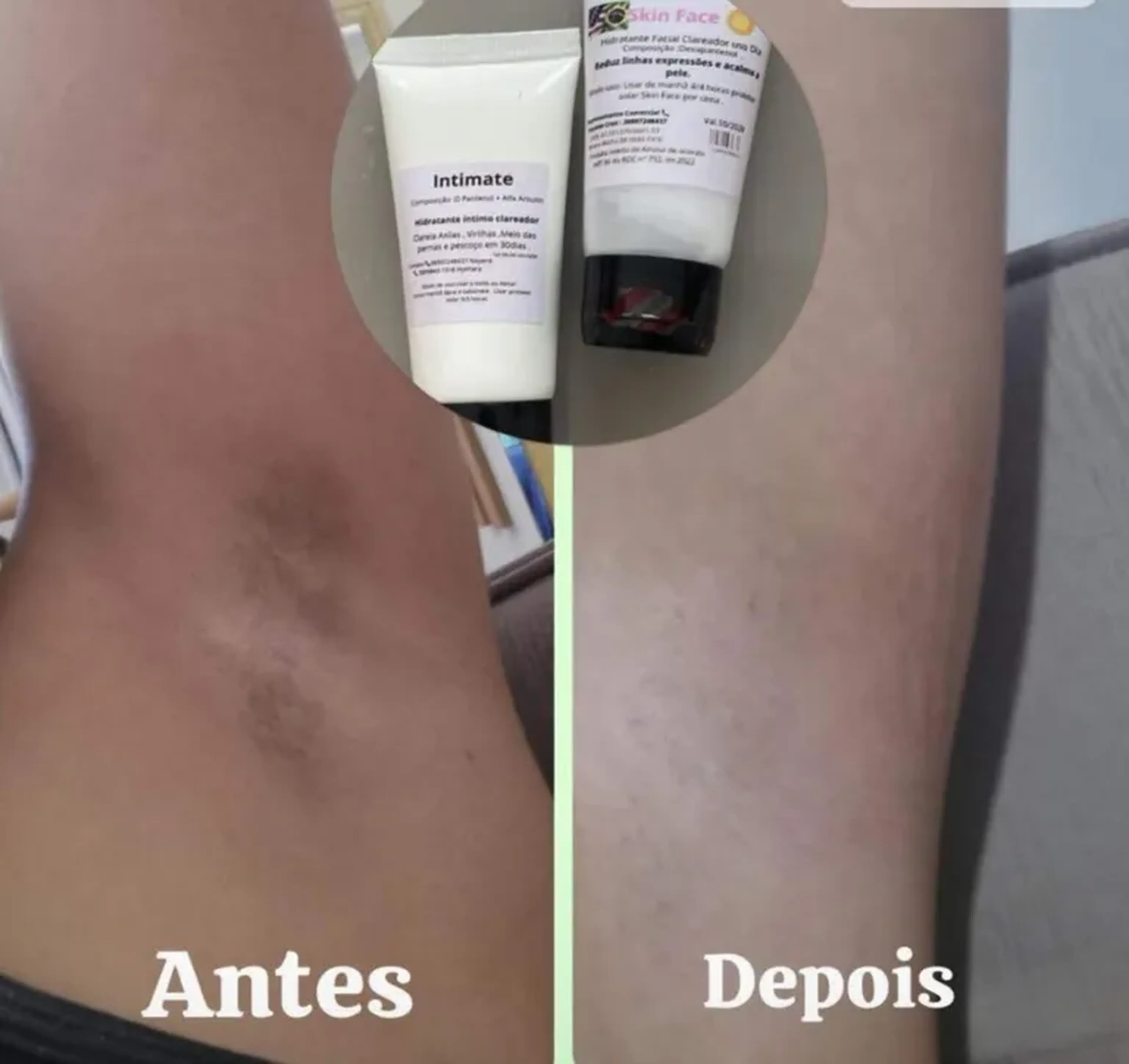 Clareador de virilha e axilas imagem