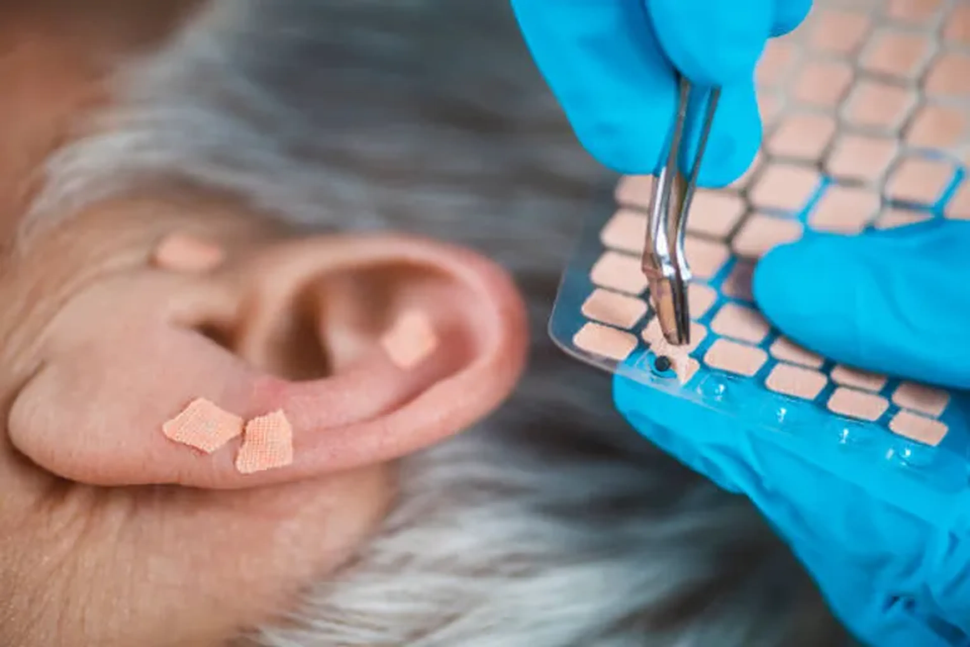 Auriculoterapia - Pacote trimestral (12 sessões) - Promoção imagem