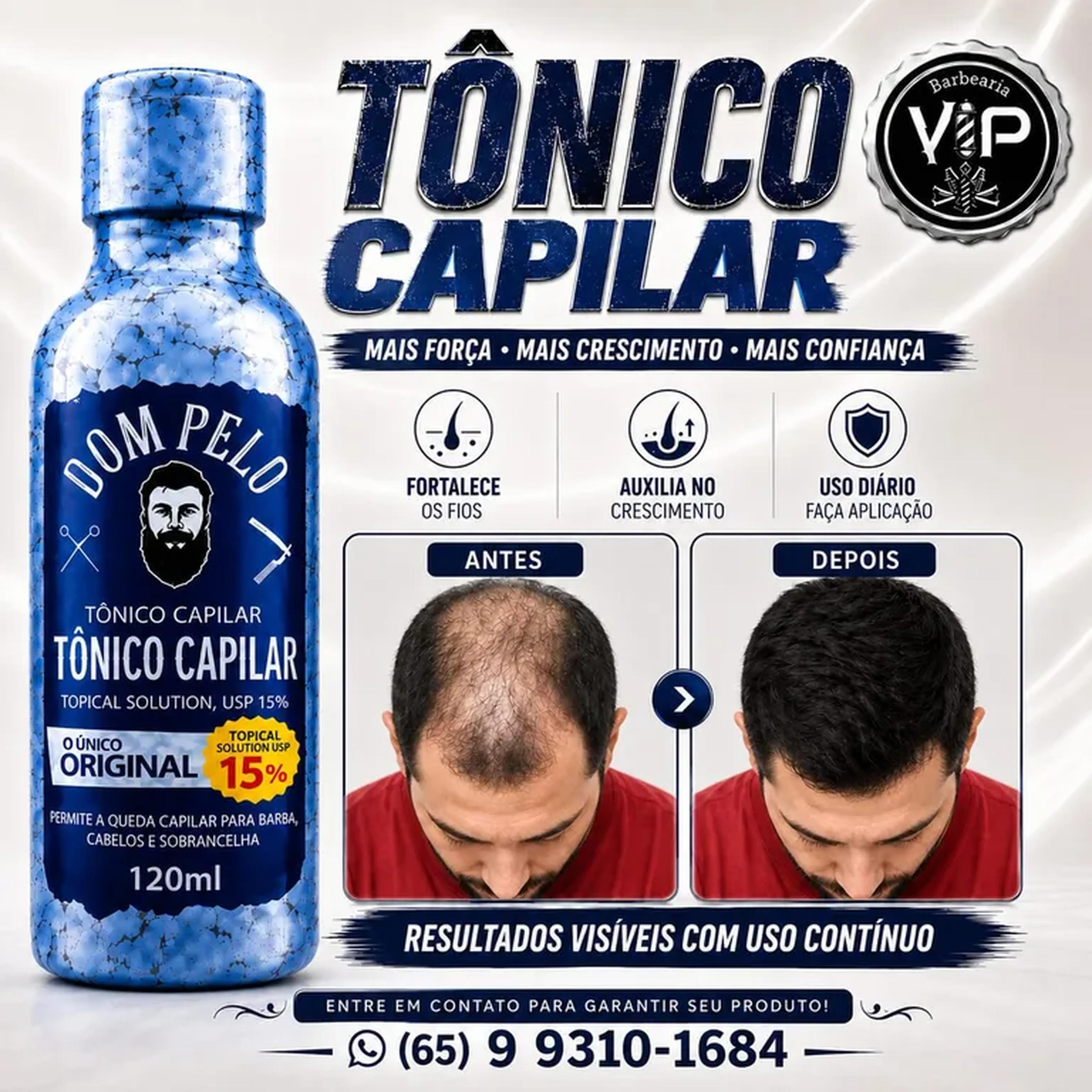 MINOXIDIL - DOM PELO 120 ml. imagem
