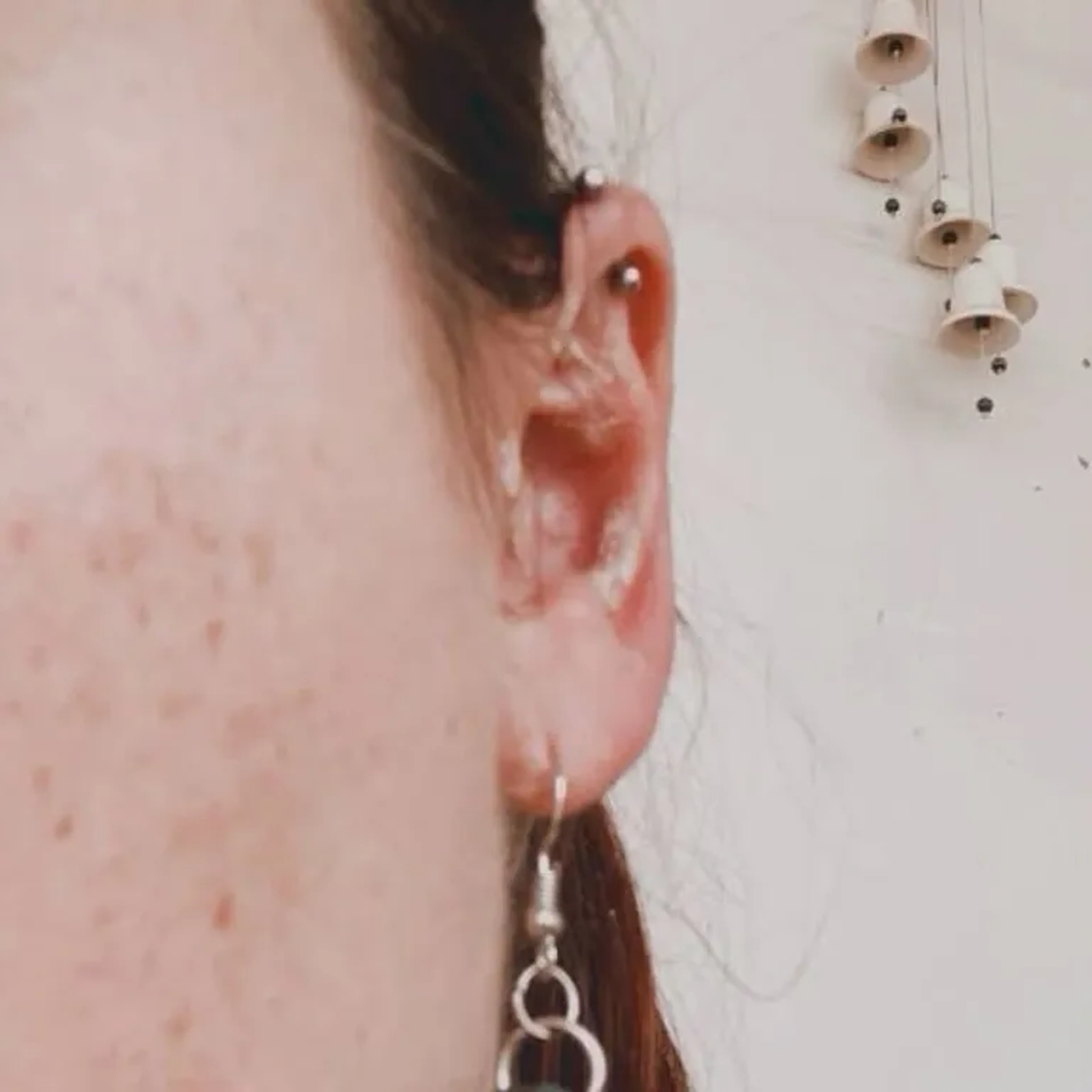 Auriculoterapia imagem