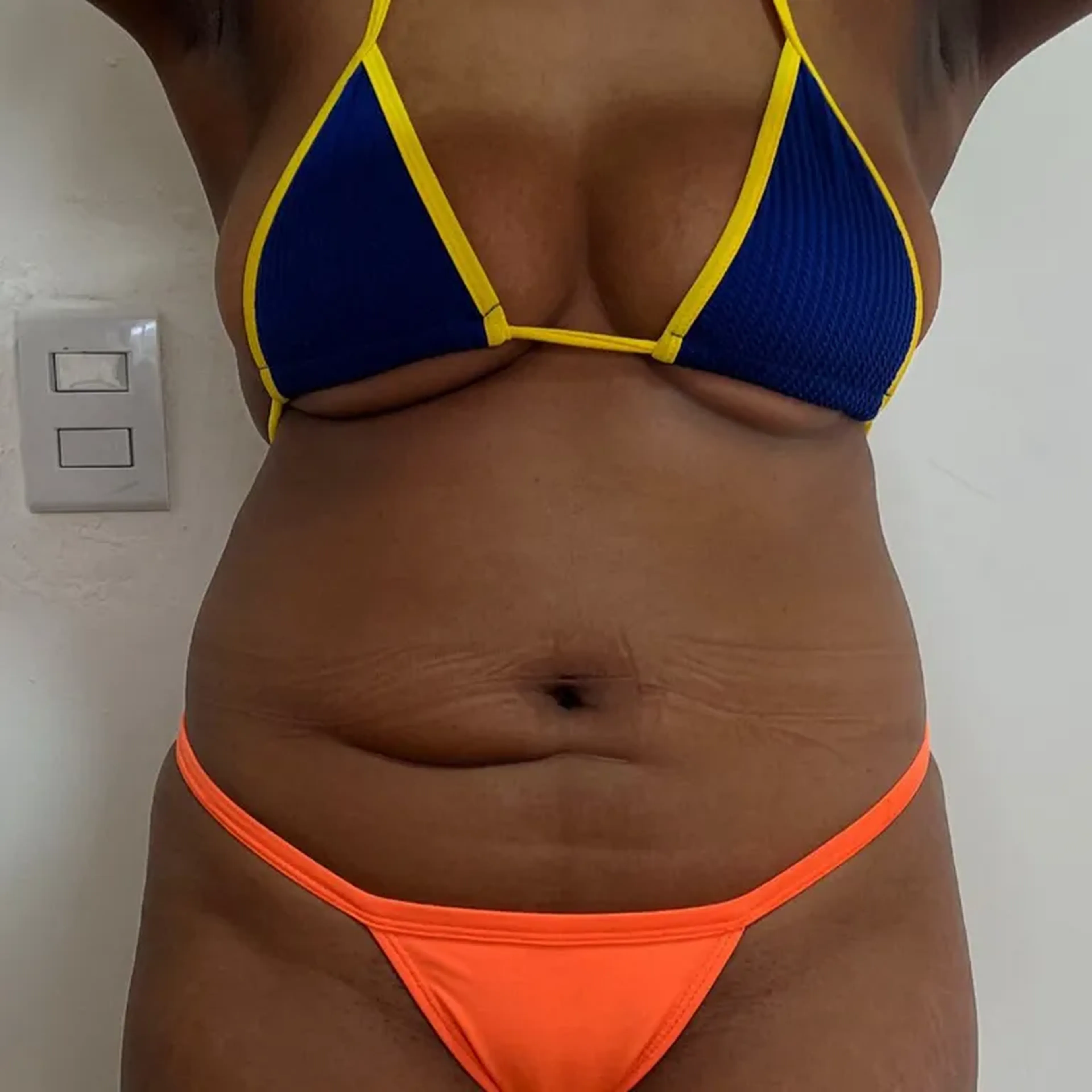 Combo LIPO enzimas 🔥💉 imagem