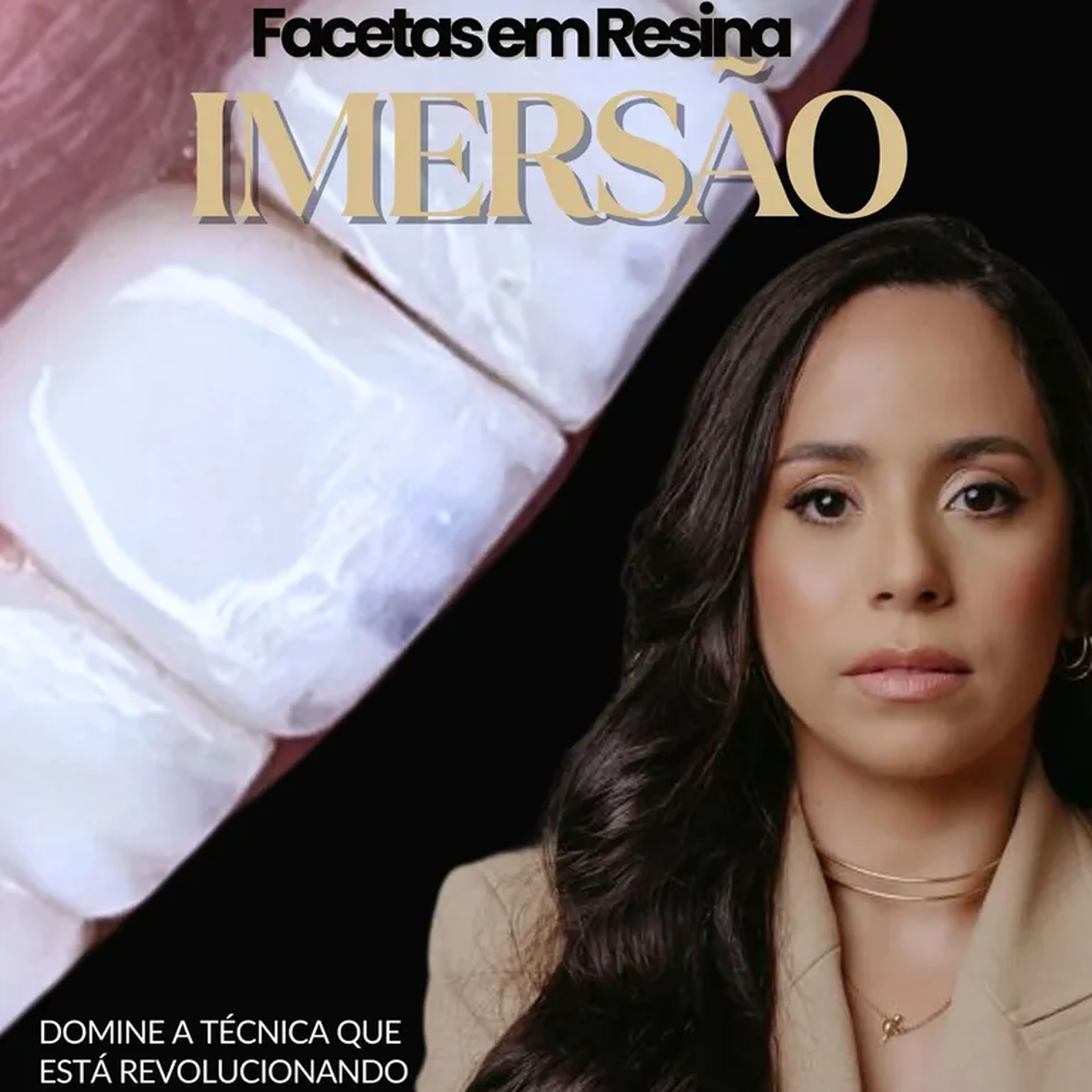 Curso de Imersão Facetas em Resina com Dra. Karolliny Barros imagem
