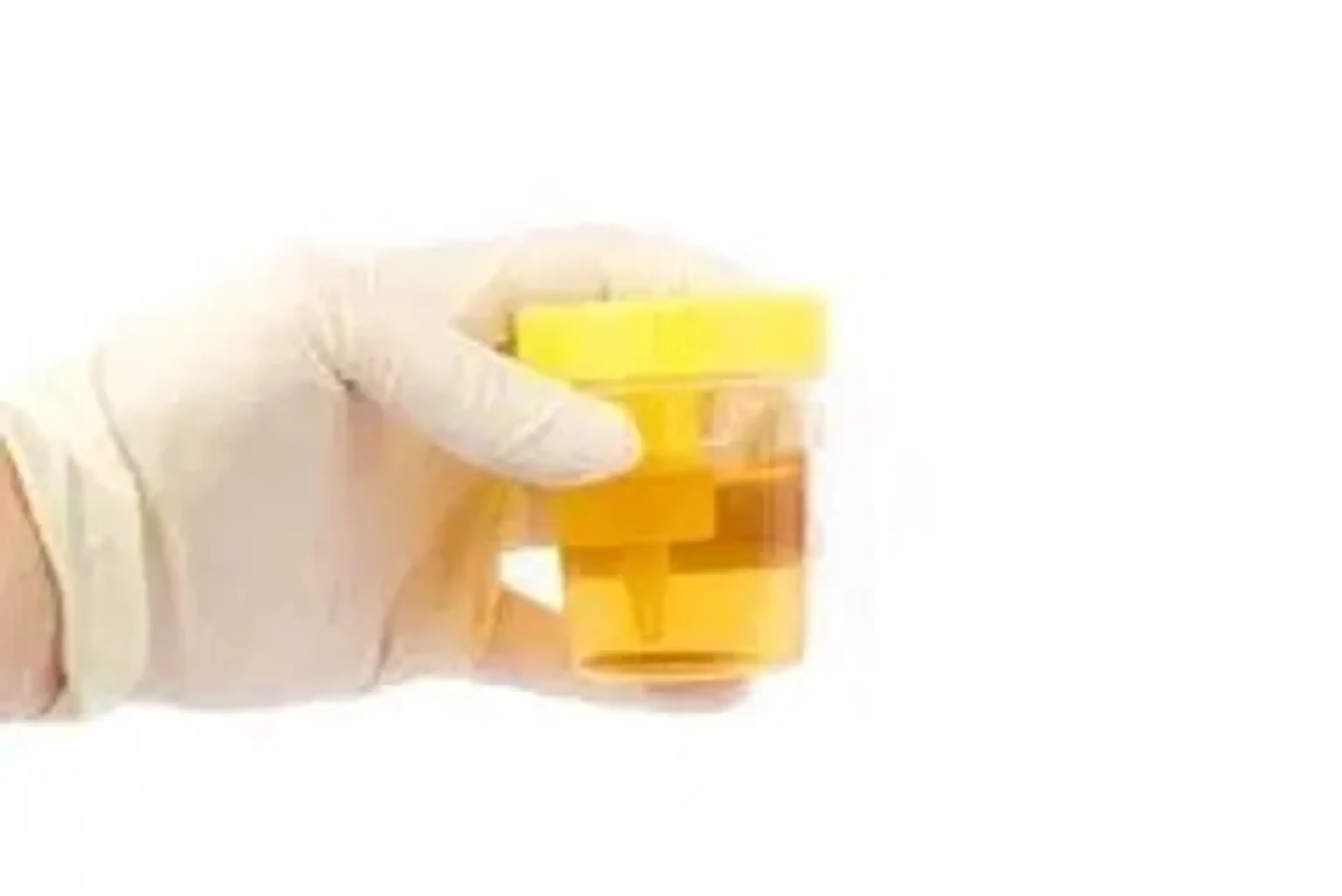 TOXICOLÓGICO URINA PADRÃO imagem