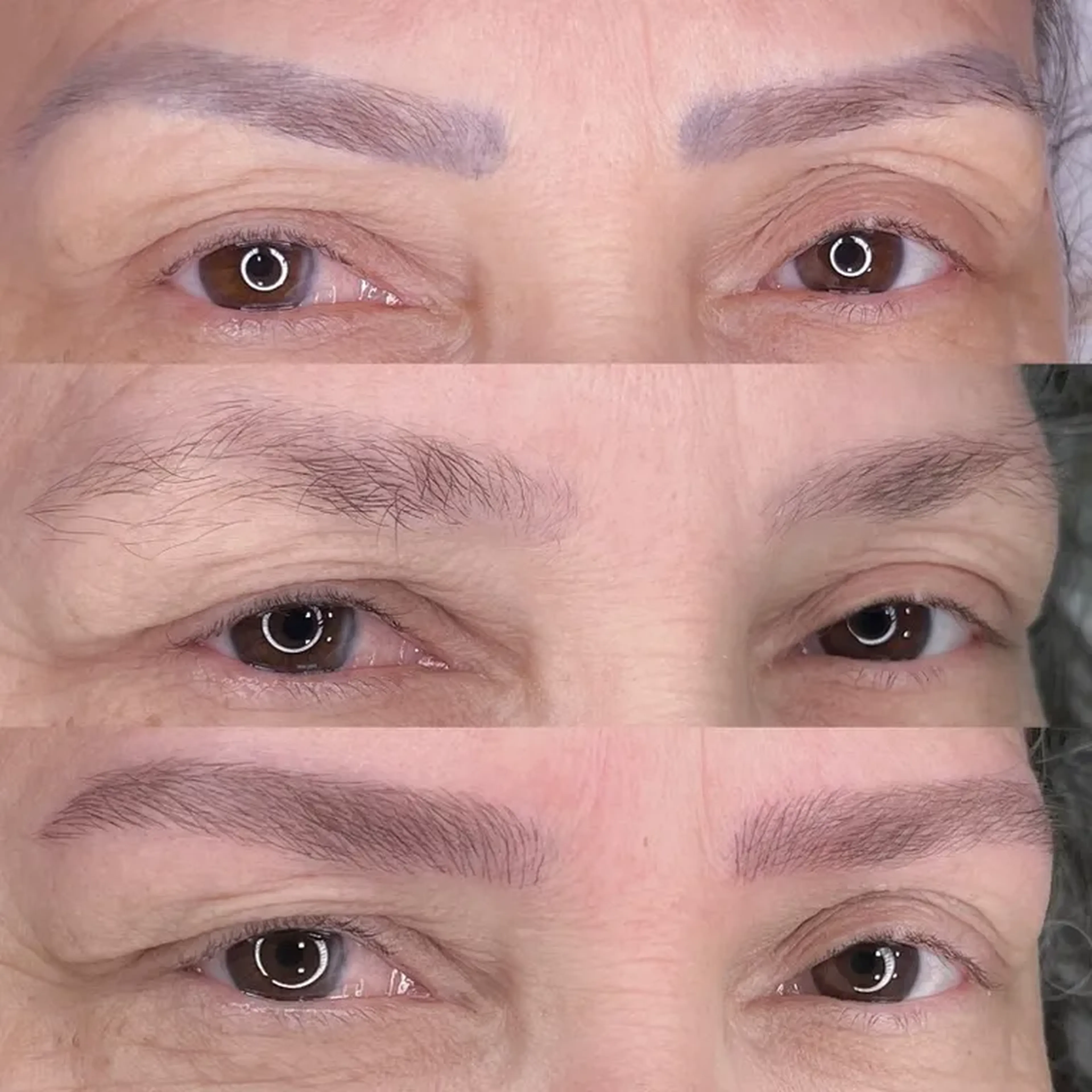 Despigmentação de Sobrancelhas - Remoção a Laser | (01 Sessão) imagem